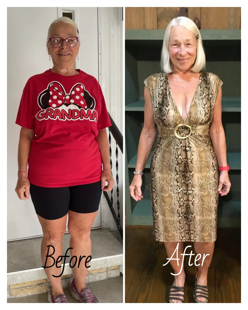 Doreen before and after weight loss