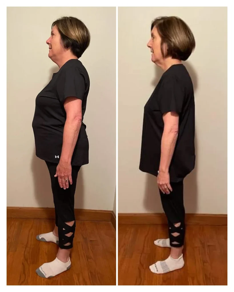Kerry before and after weight loss side view