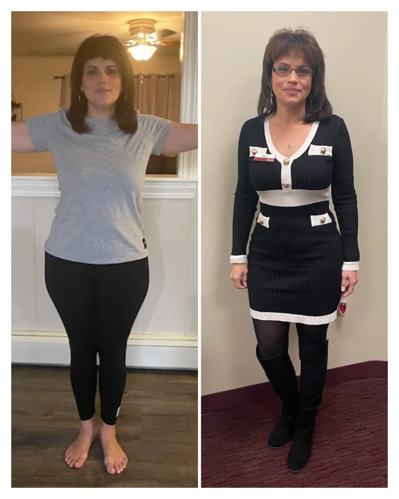 Daisy before & after weight loss