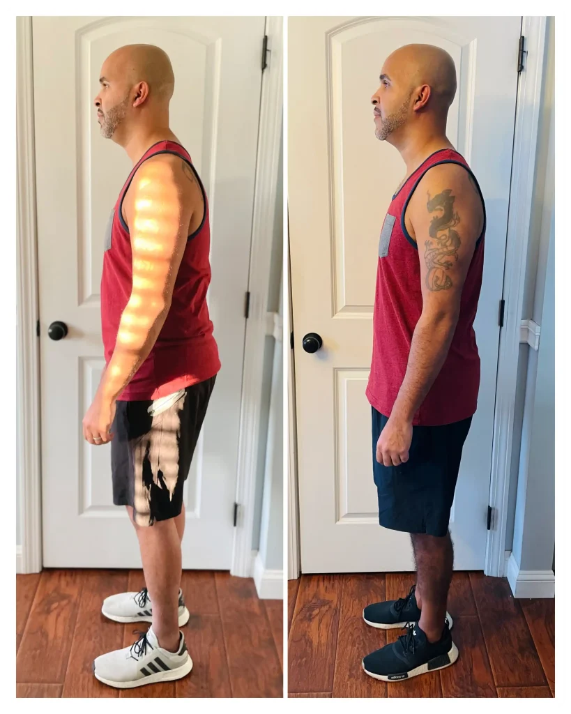 Jonathan before & after weight loss side view