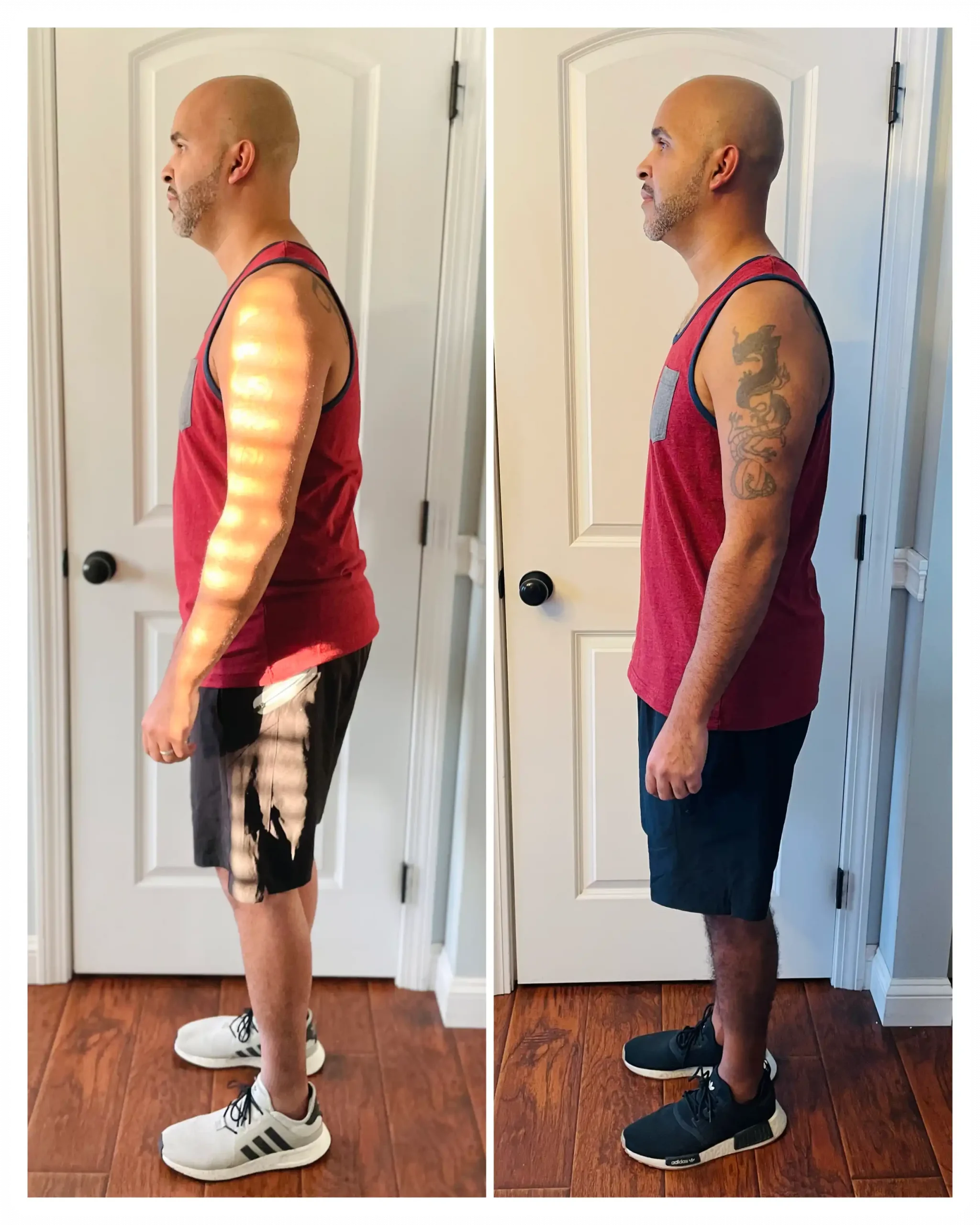 Jonathan before & after weight loss side view