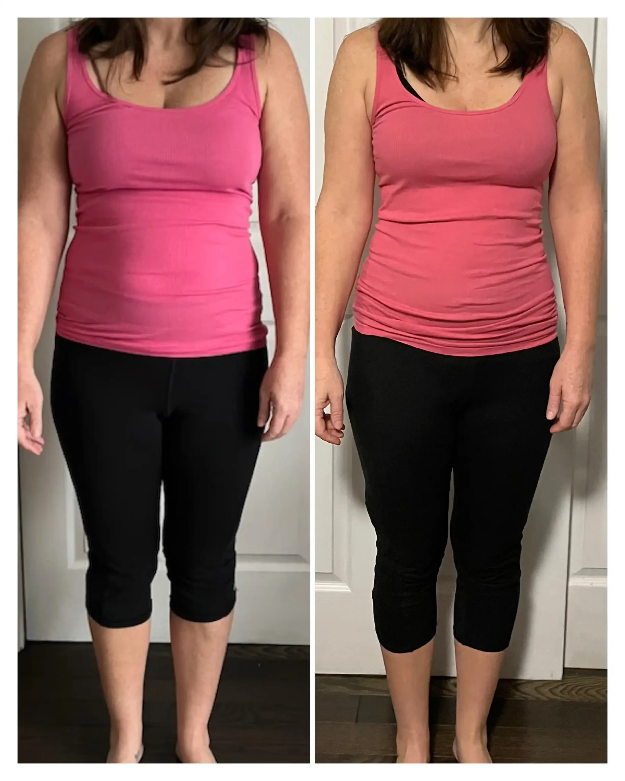 Kelly Before & After Weight Loss front view