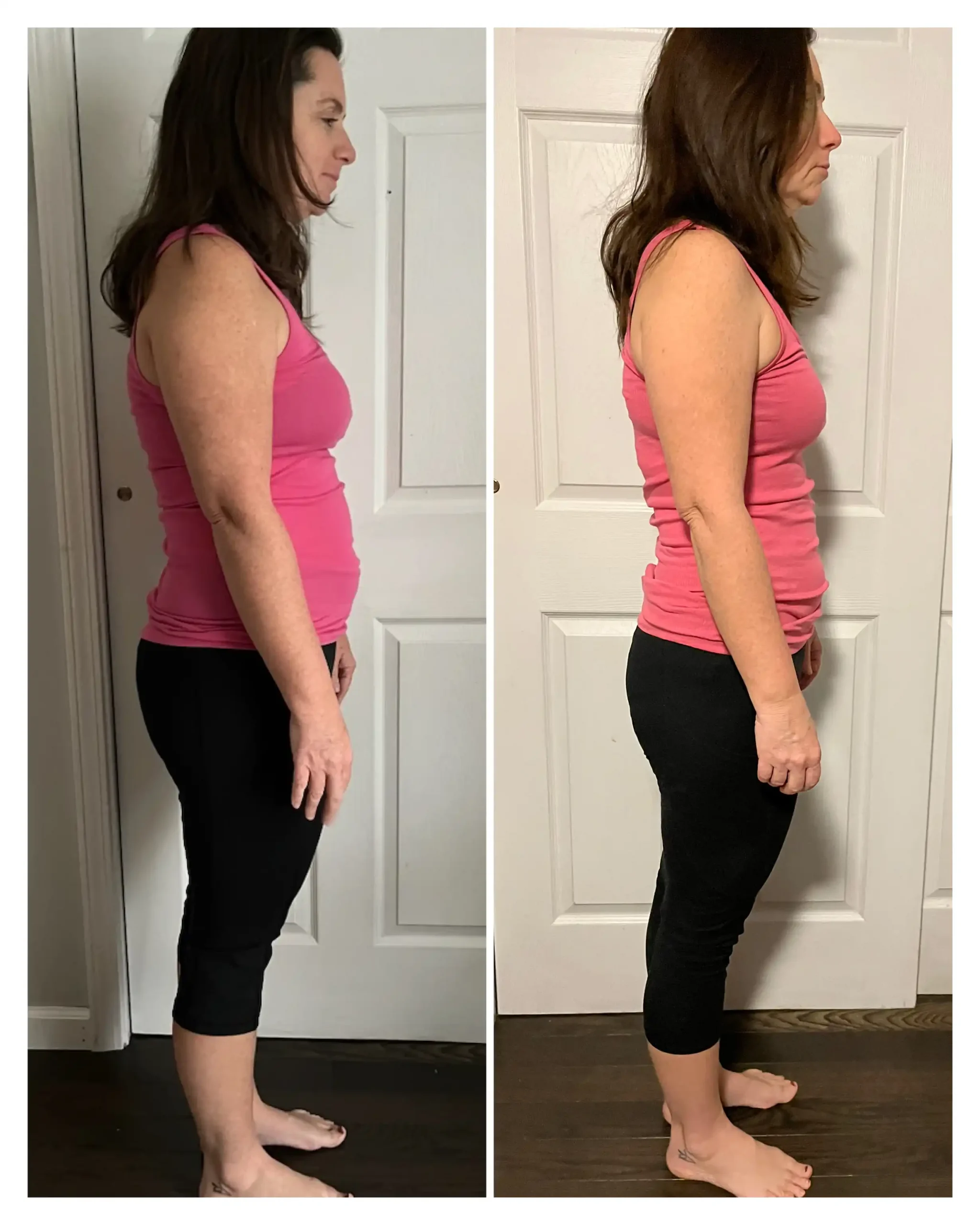 Kelly Before & After Weight Loss side view