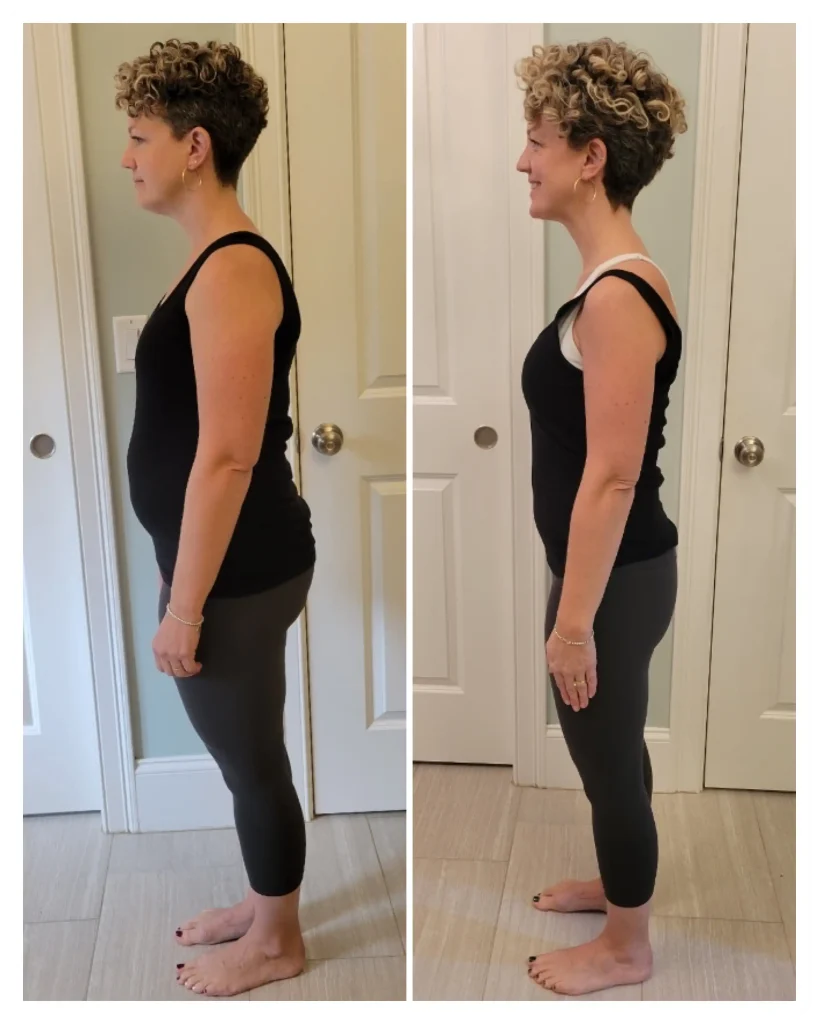 Tara Before & After Weight Loss side view