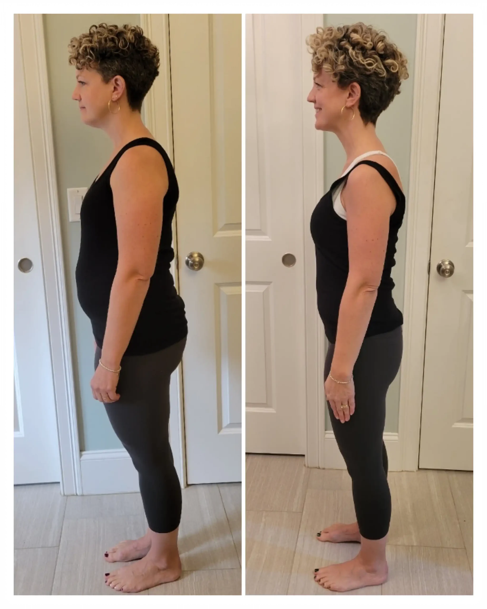 Tara Before & After Weight Loss side view