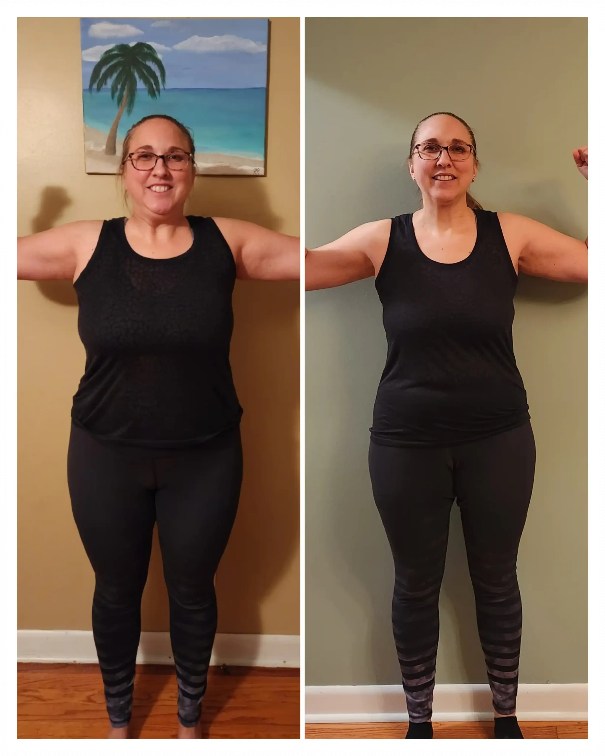 Barbara before and after weight loss front view