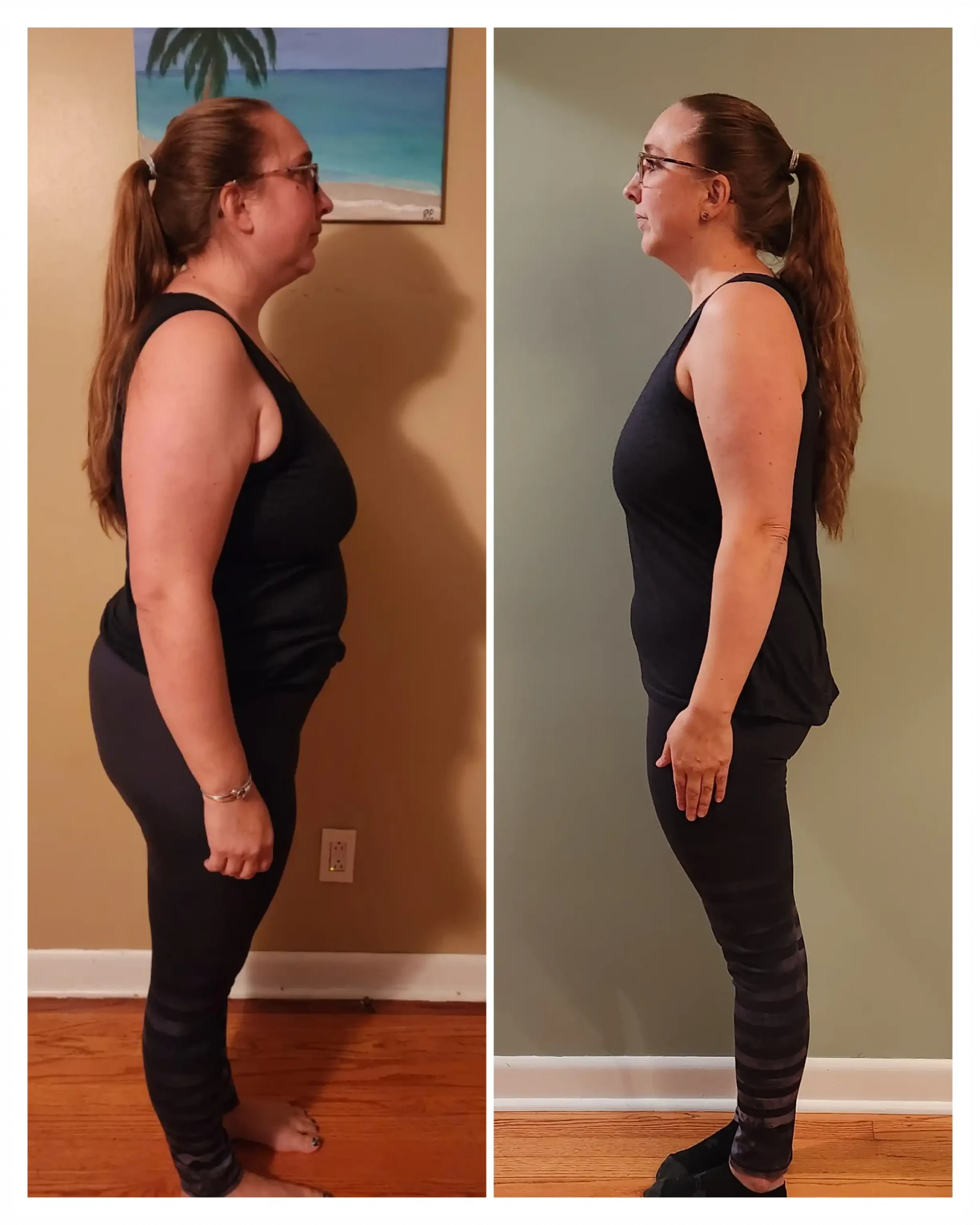 Barbara before and after weight loss side view