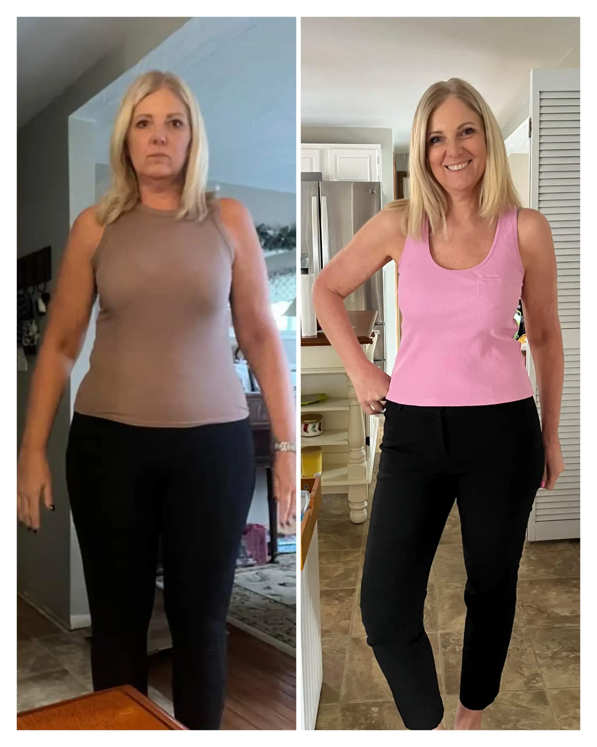 Tracey before & after weight loss