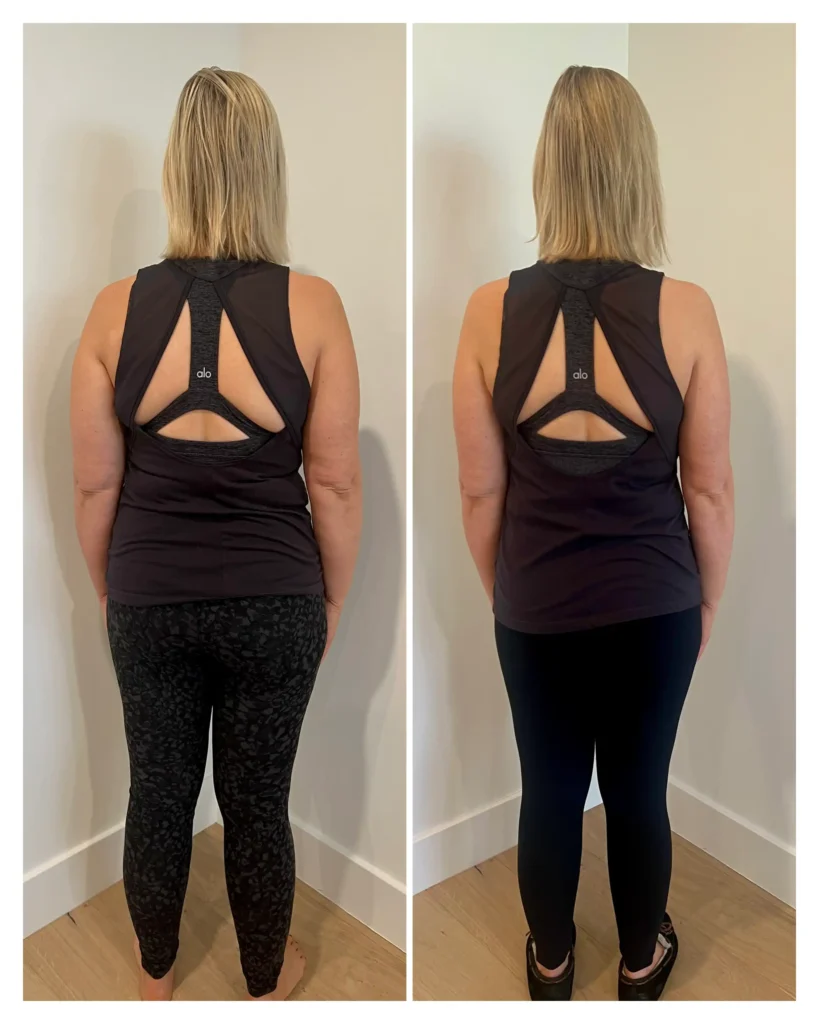 Melissa before and after weight loss - back view