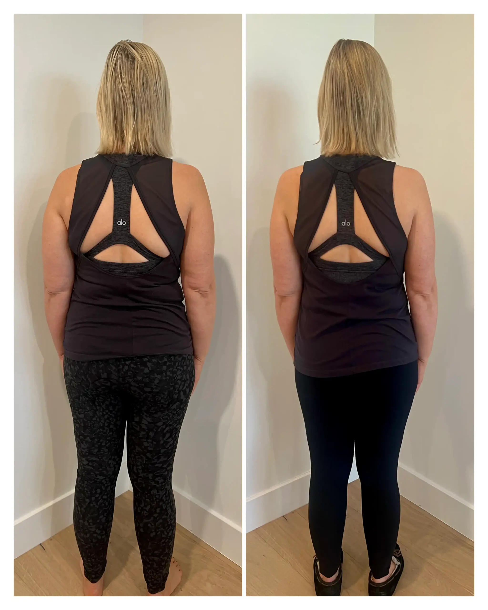 Melissa before and after weight loss - back view