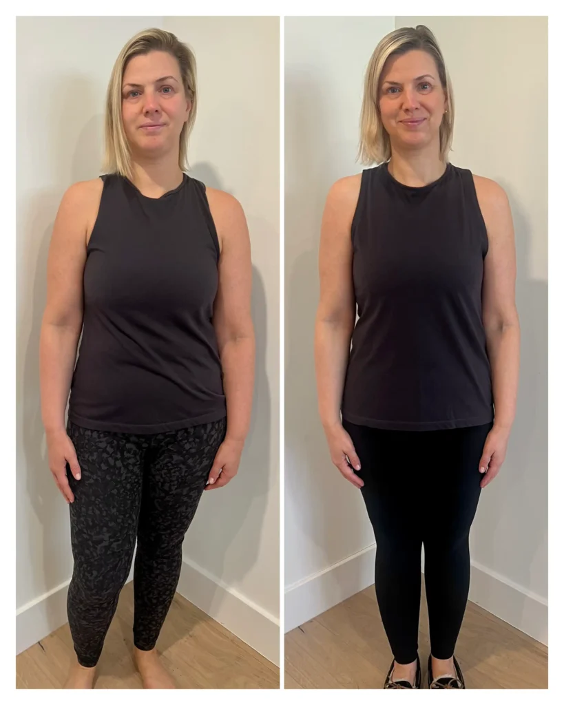 Melissa before and after weight loss - front view