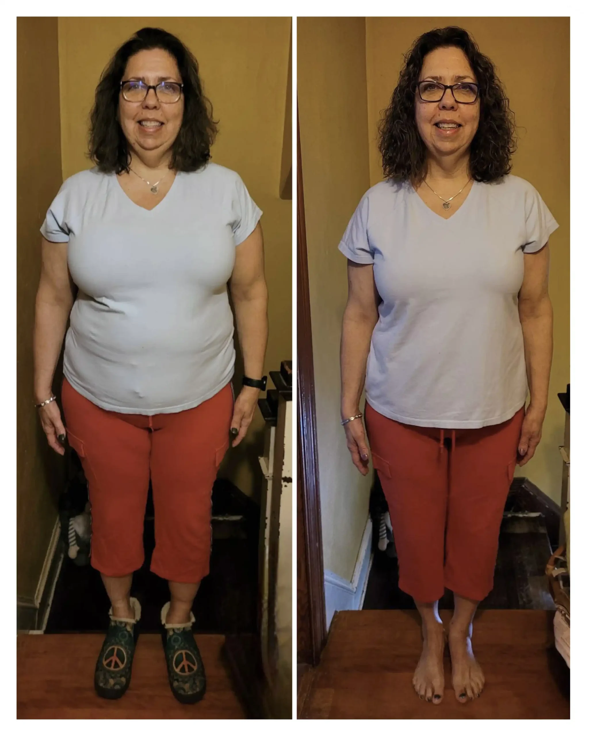 Rebecca before & after weight loss - front view