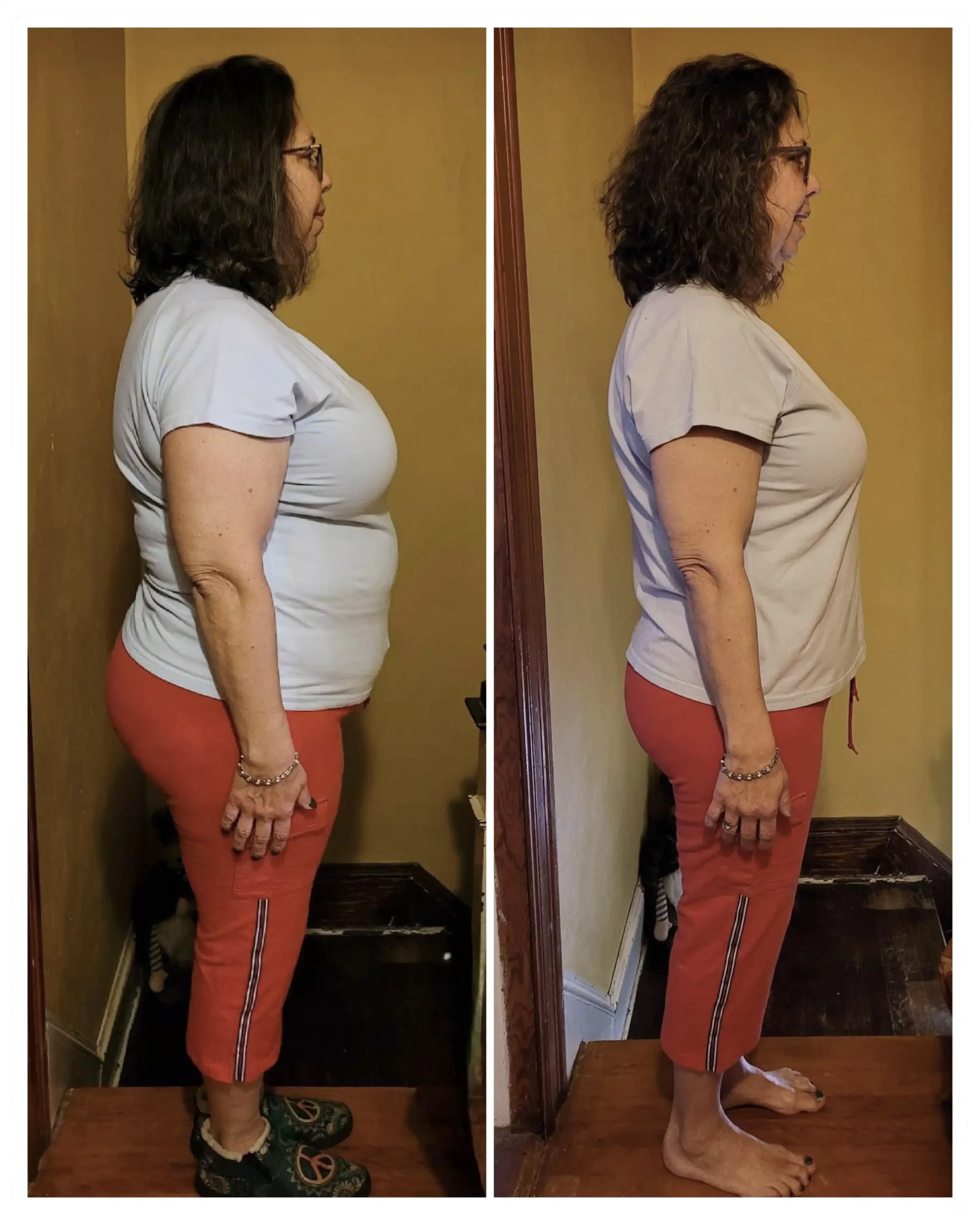 Rebecca before & after weight loss - side view