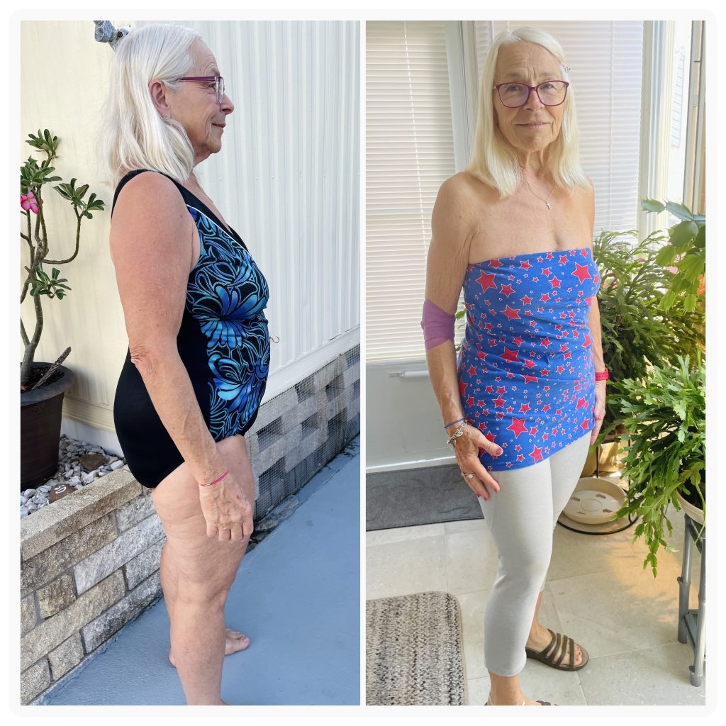 Doreen before and after weight loss