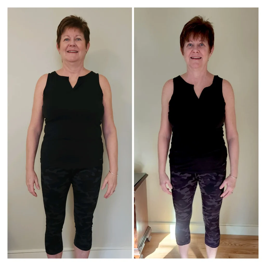 Donna D before and after weight loss front view