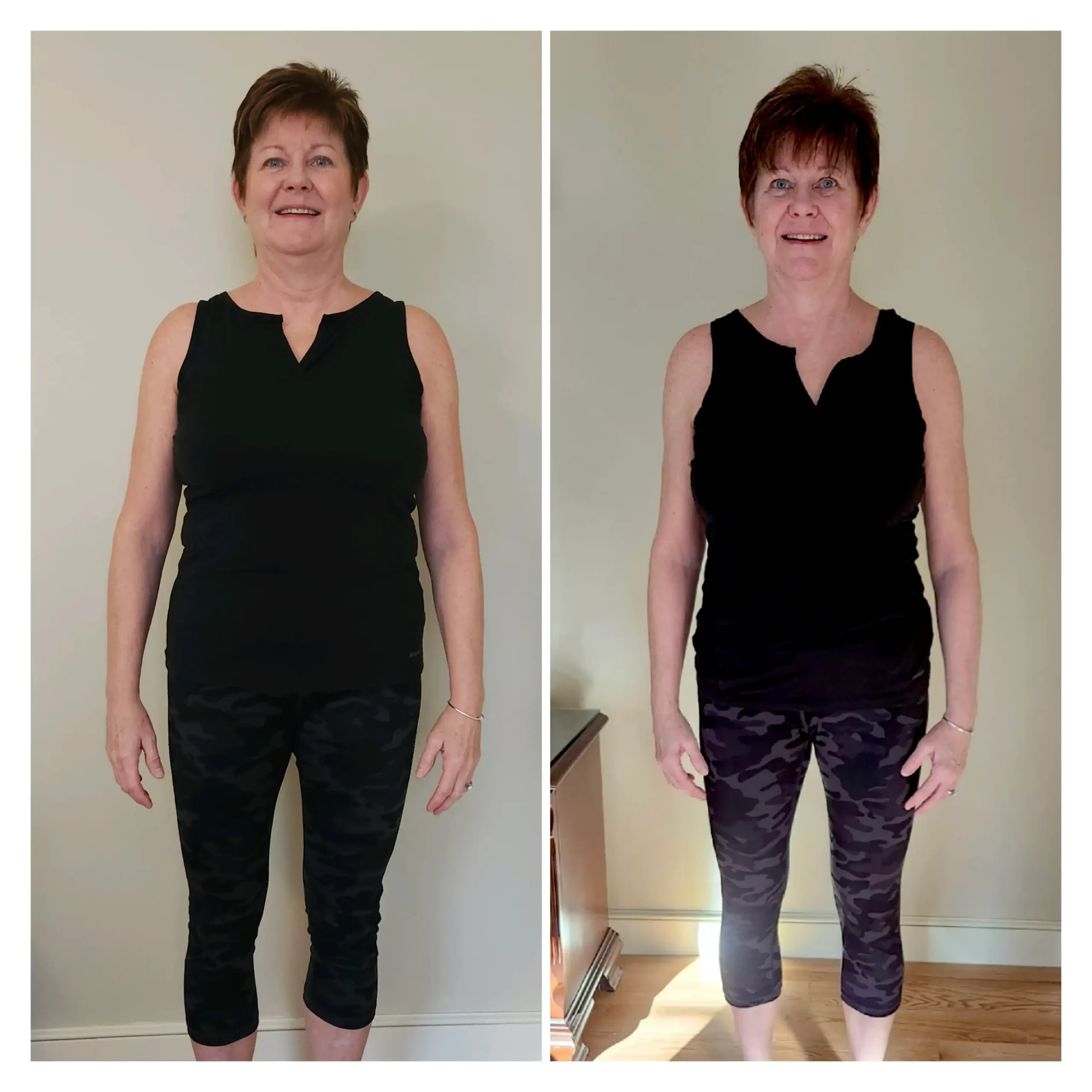 Donna D before and after weight loss front view