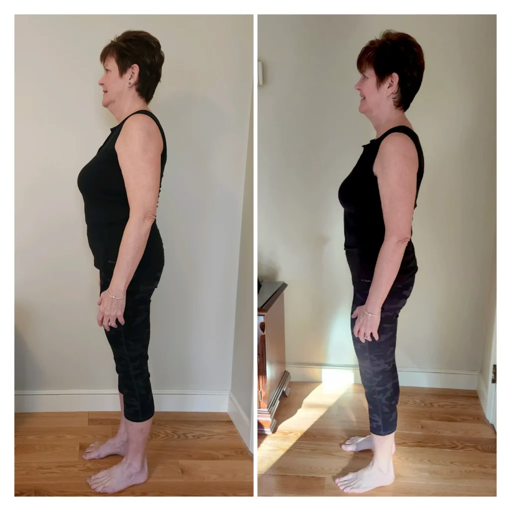 Donna D before and after weight loss side view