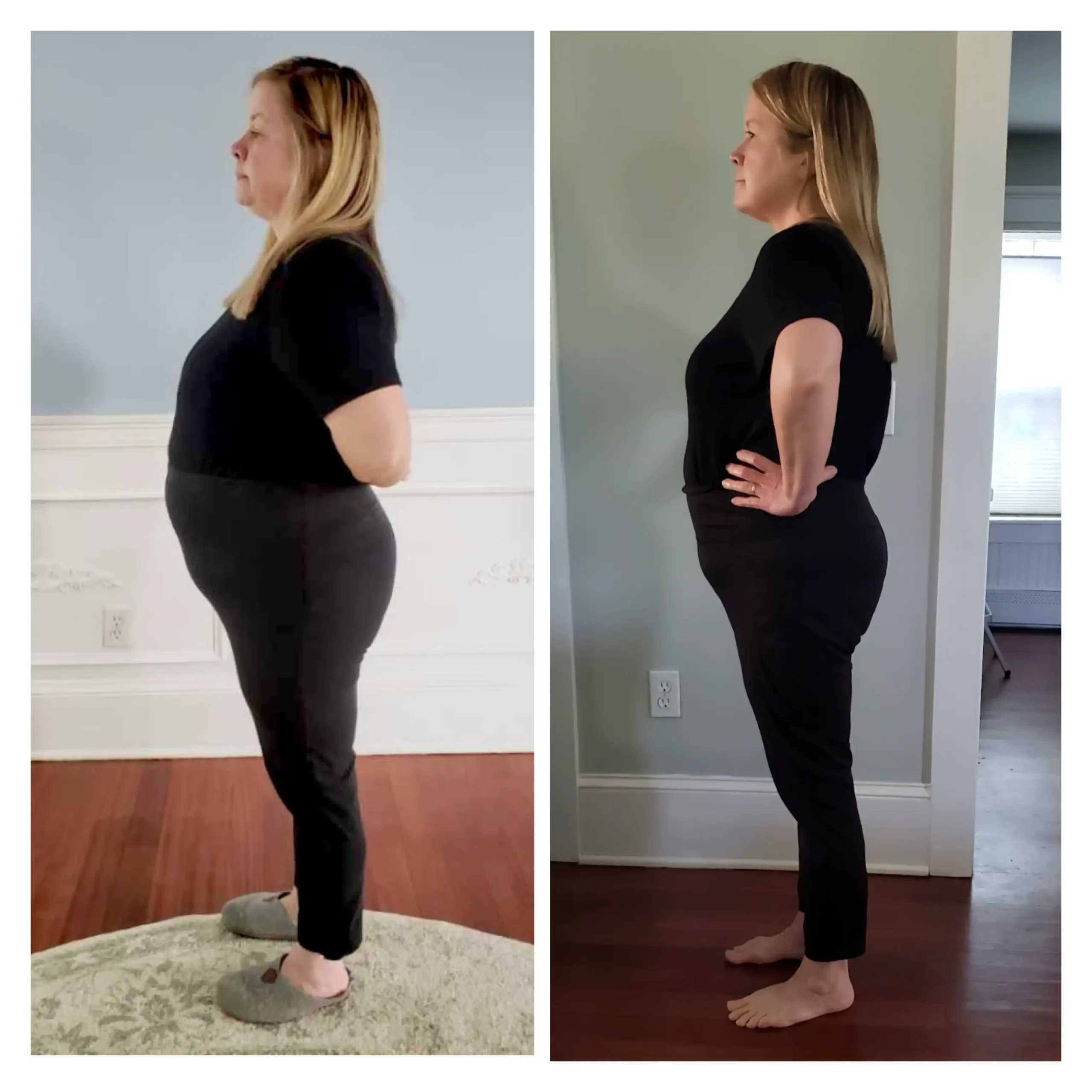 Donna O before and after weight loss side view