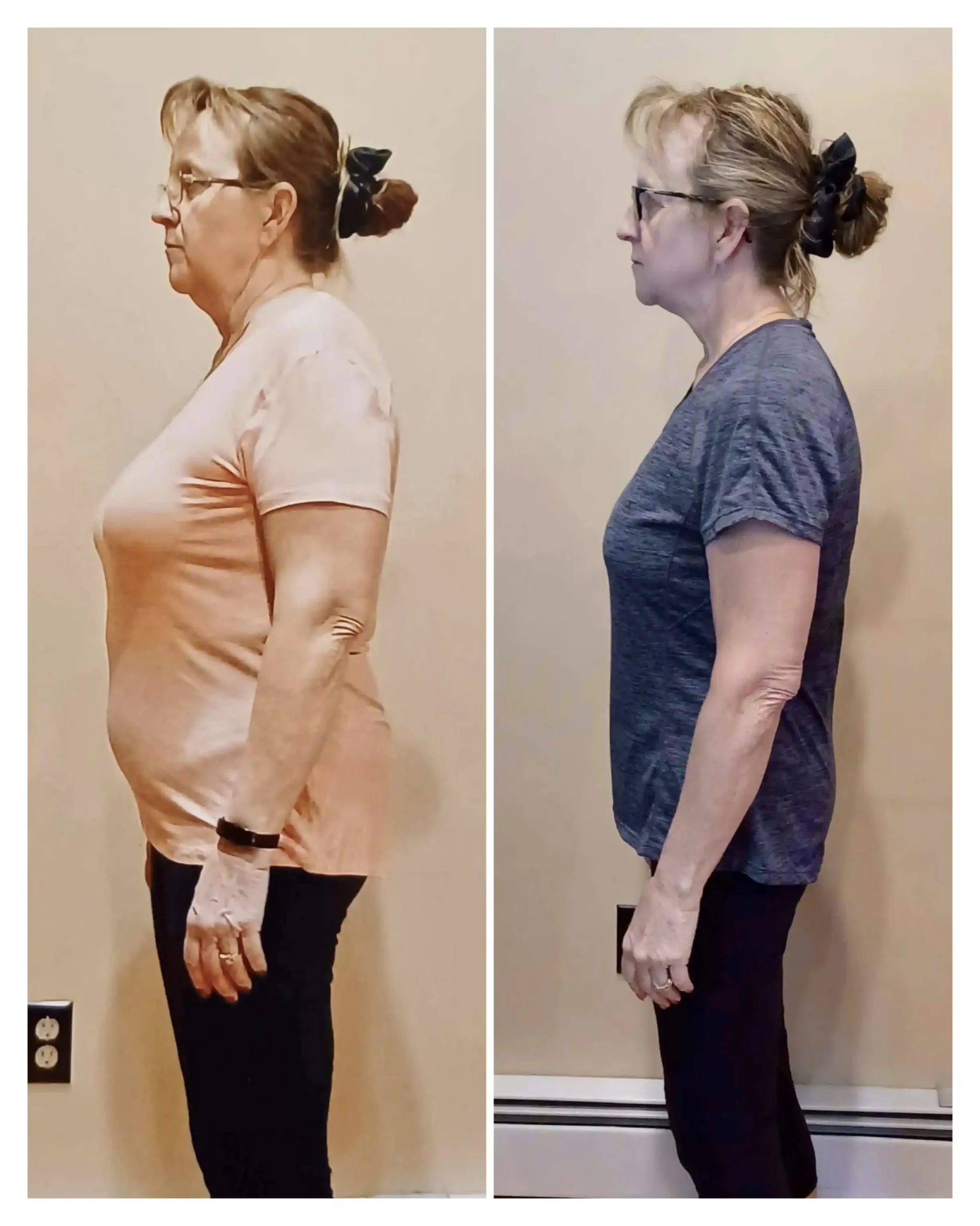 Tina before and after weight loss side view