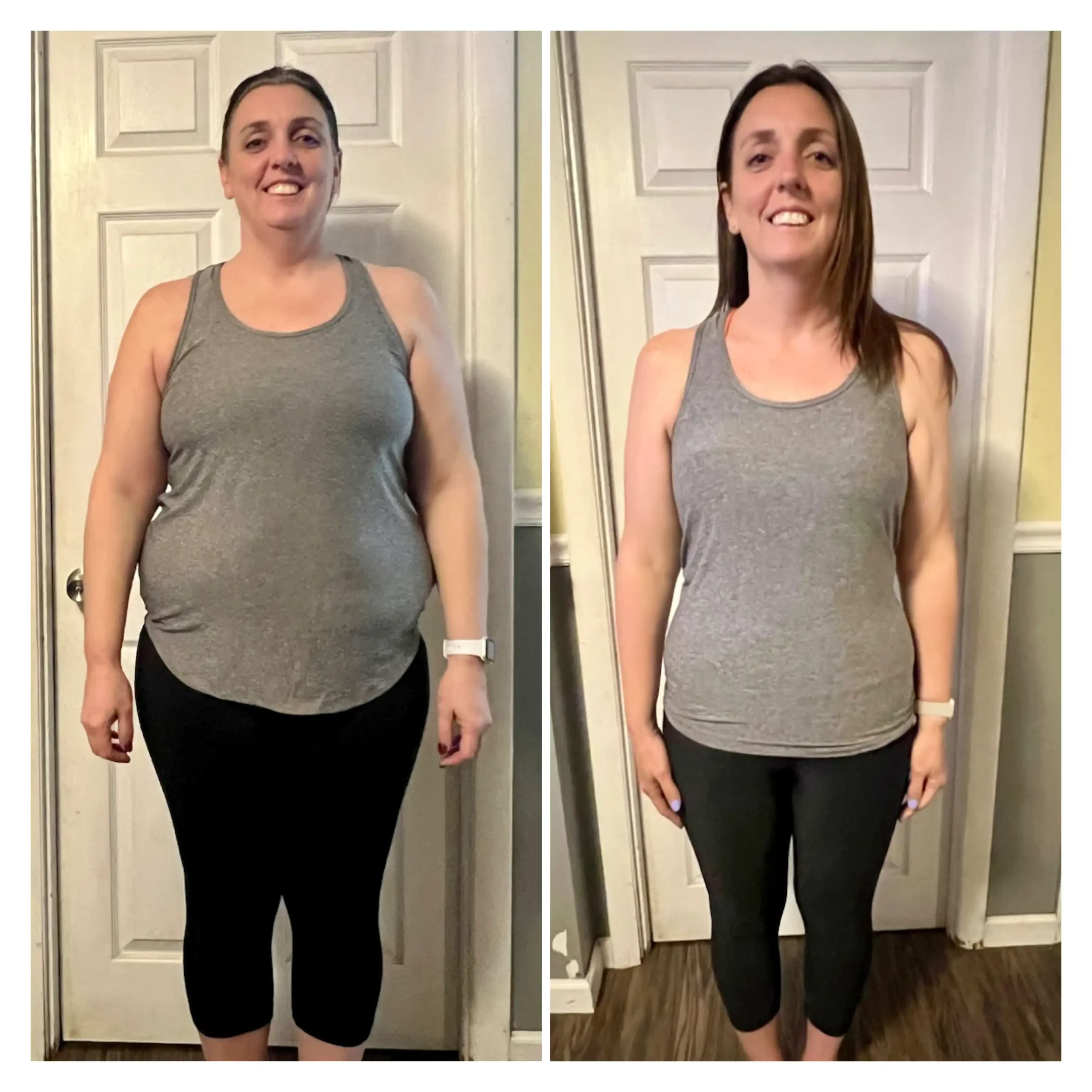 Julie before and after weight loss front view