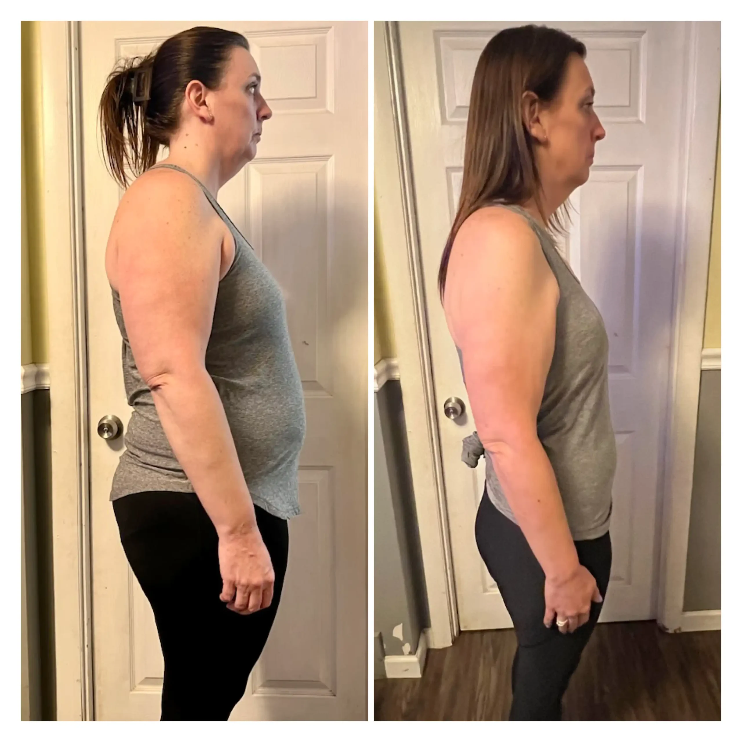 Julie before and after weight loss side view