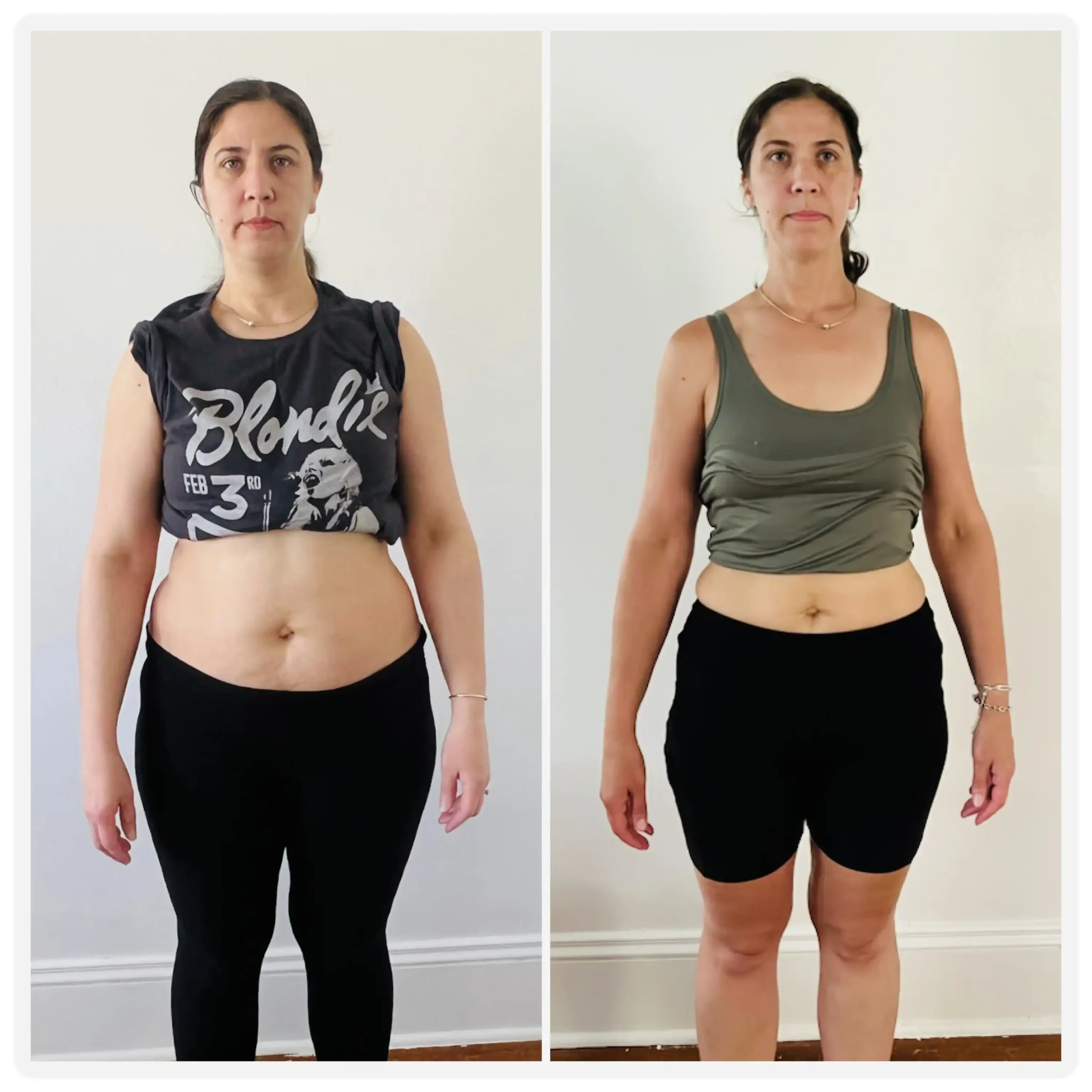 Daliana before and after weight loss front view