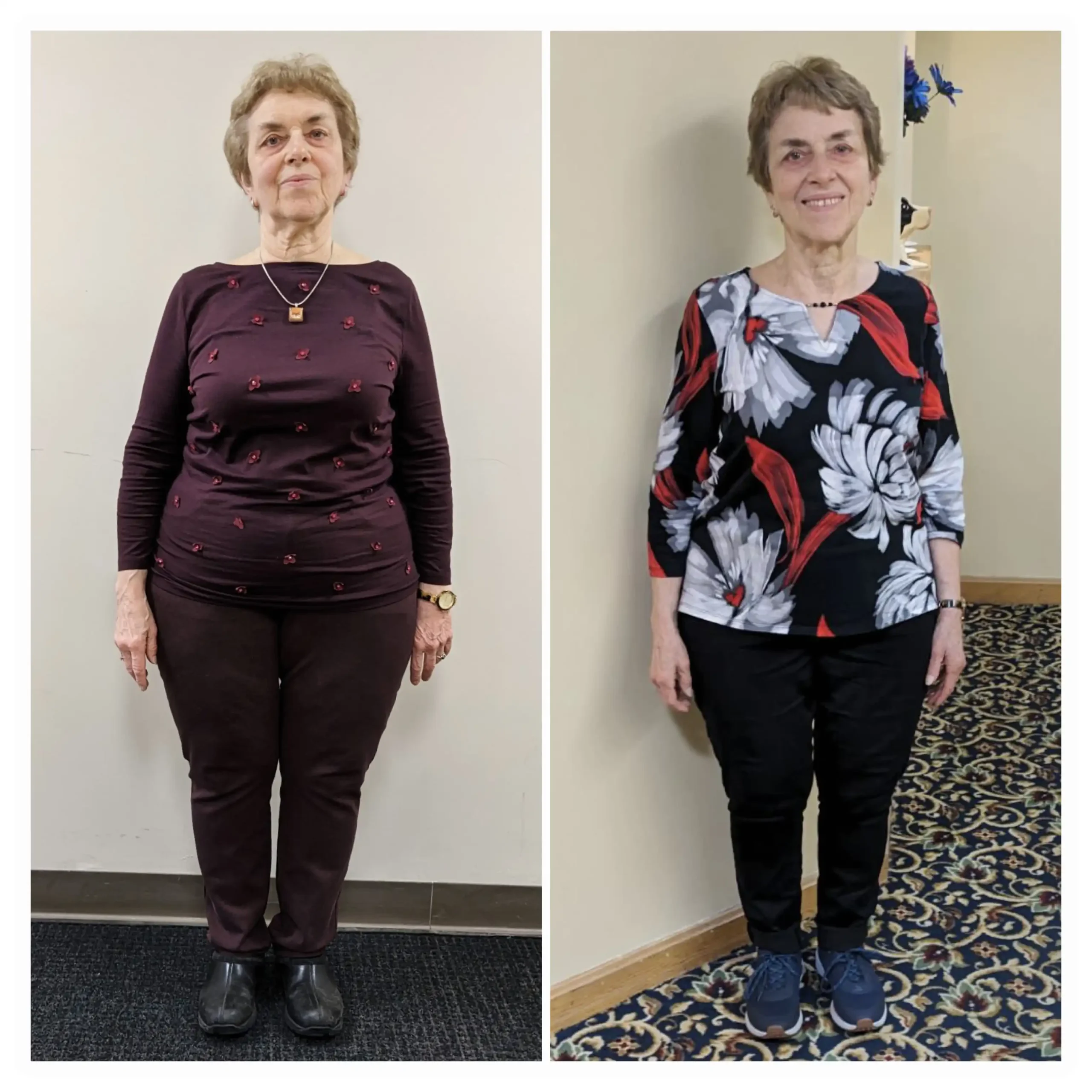 Diane before and after weight loss front view