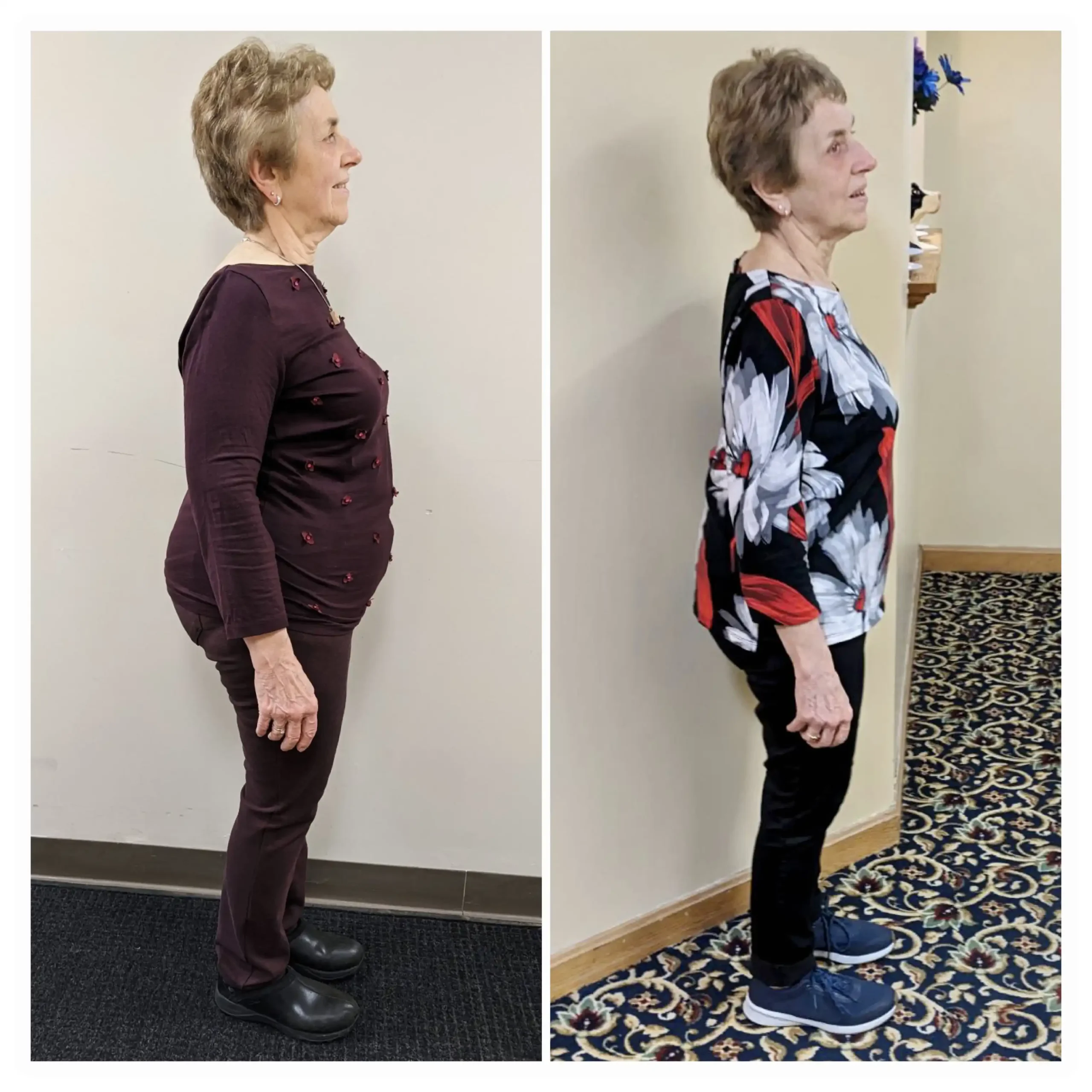 Diane before and after weight loss side view