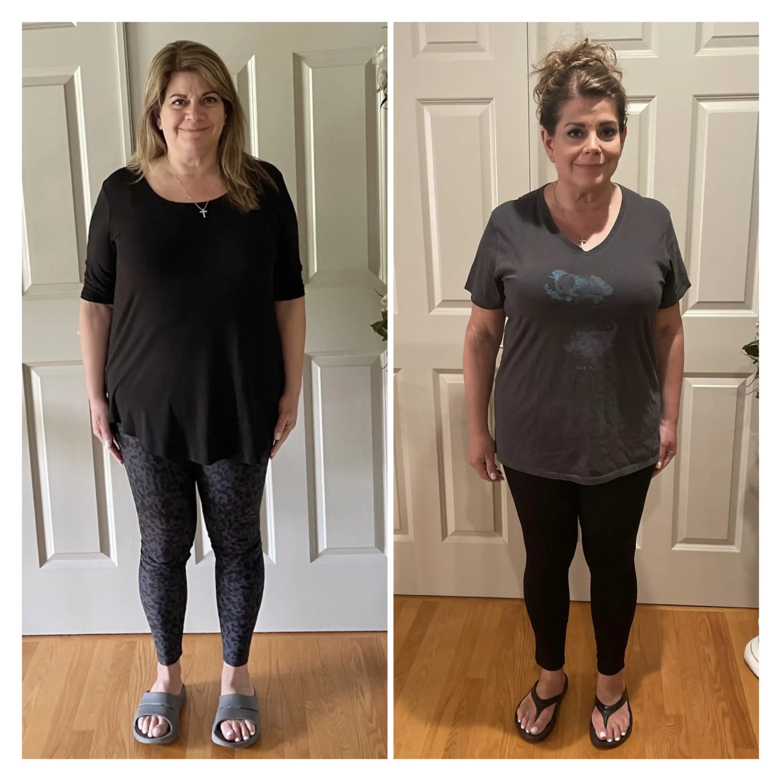 Martine before and after weight loss