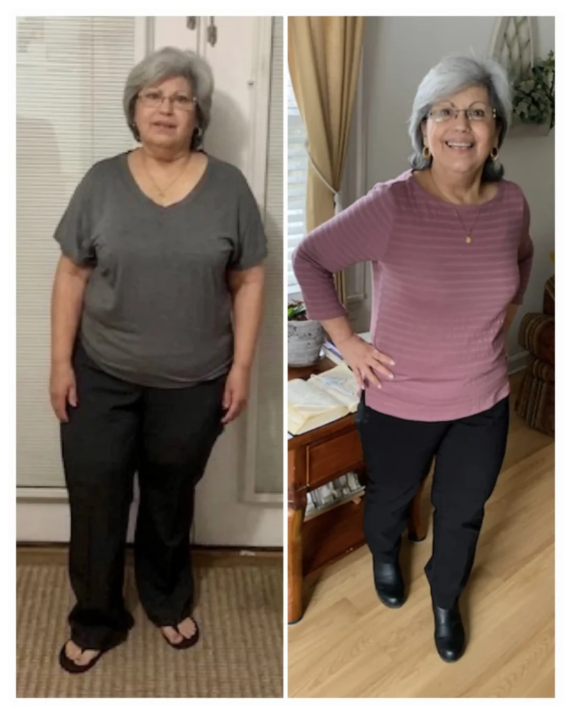 Aurea before and after weight loss