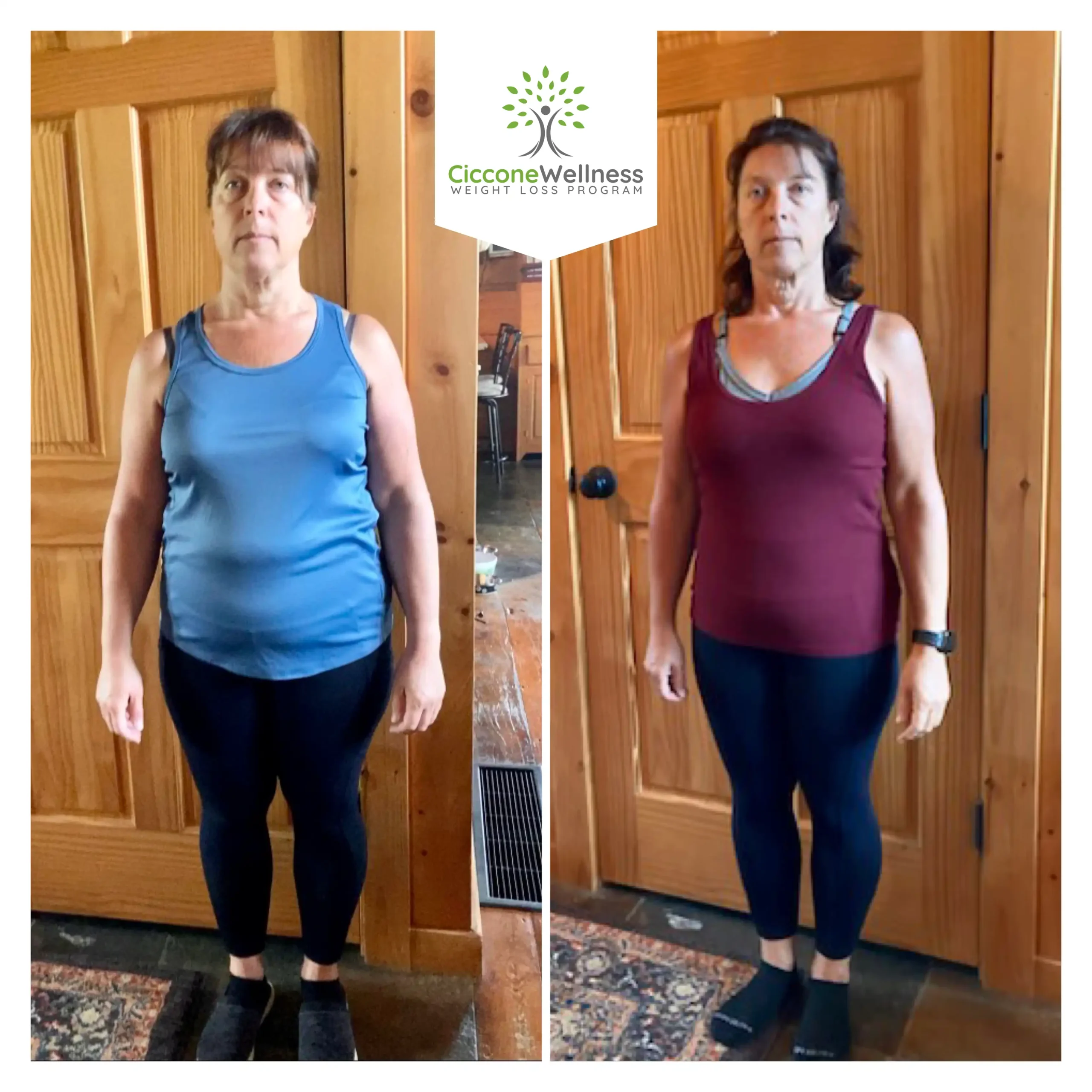 Donna P. before and after weight loss front view