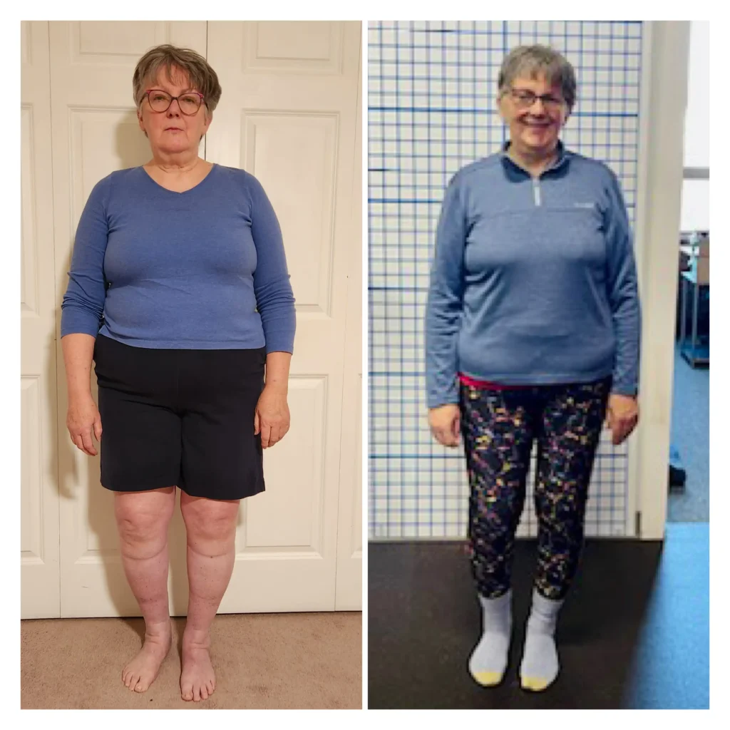 Sharon before and after weight loss