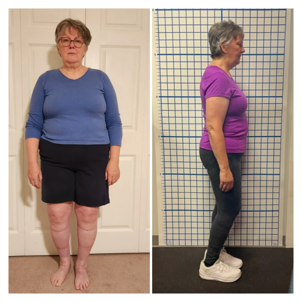 Sharon before and after weight loss at 4 months