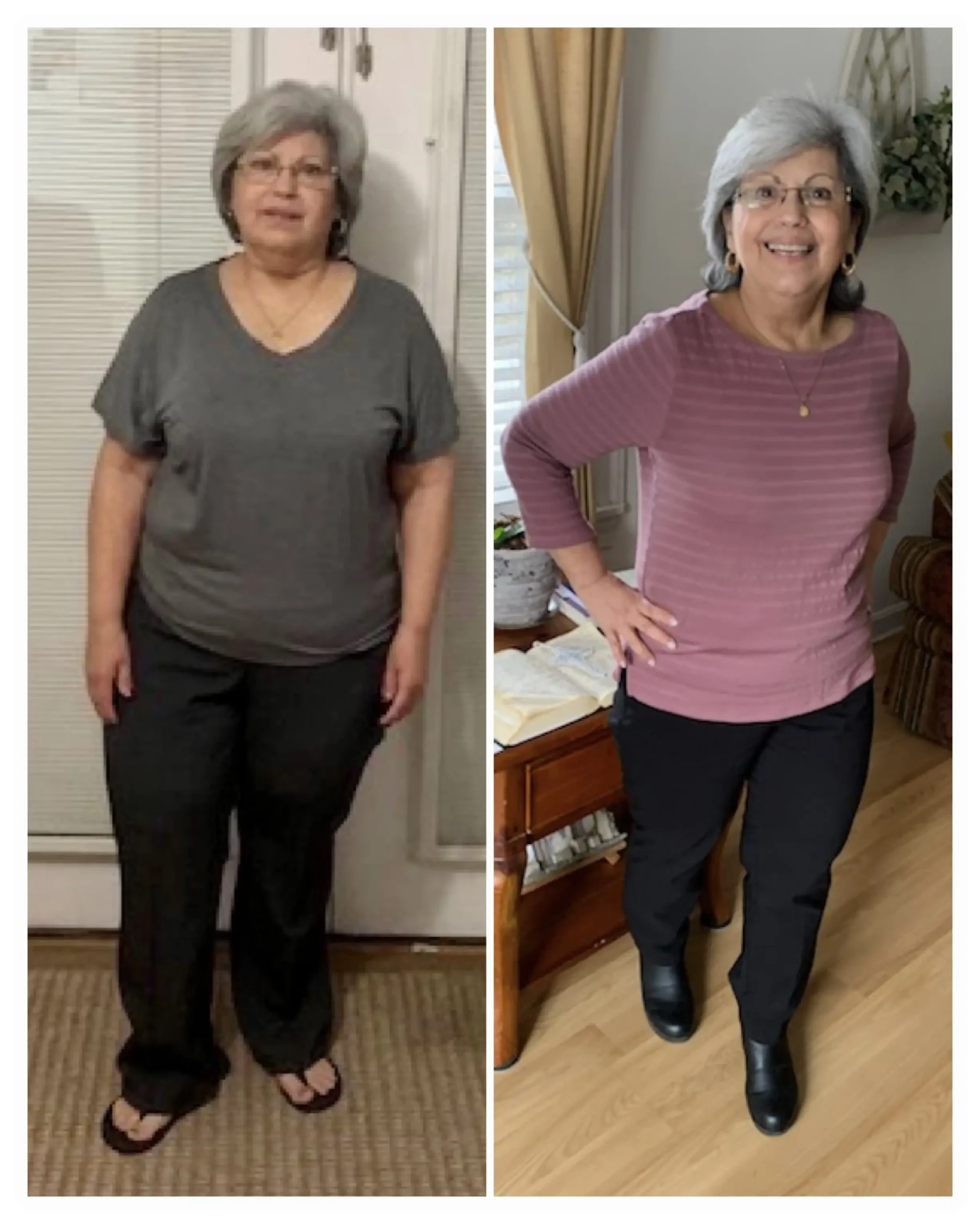 Aurea before and after weight loss front view