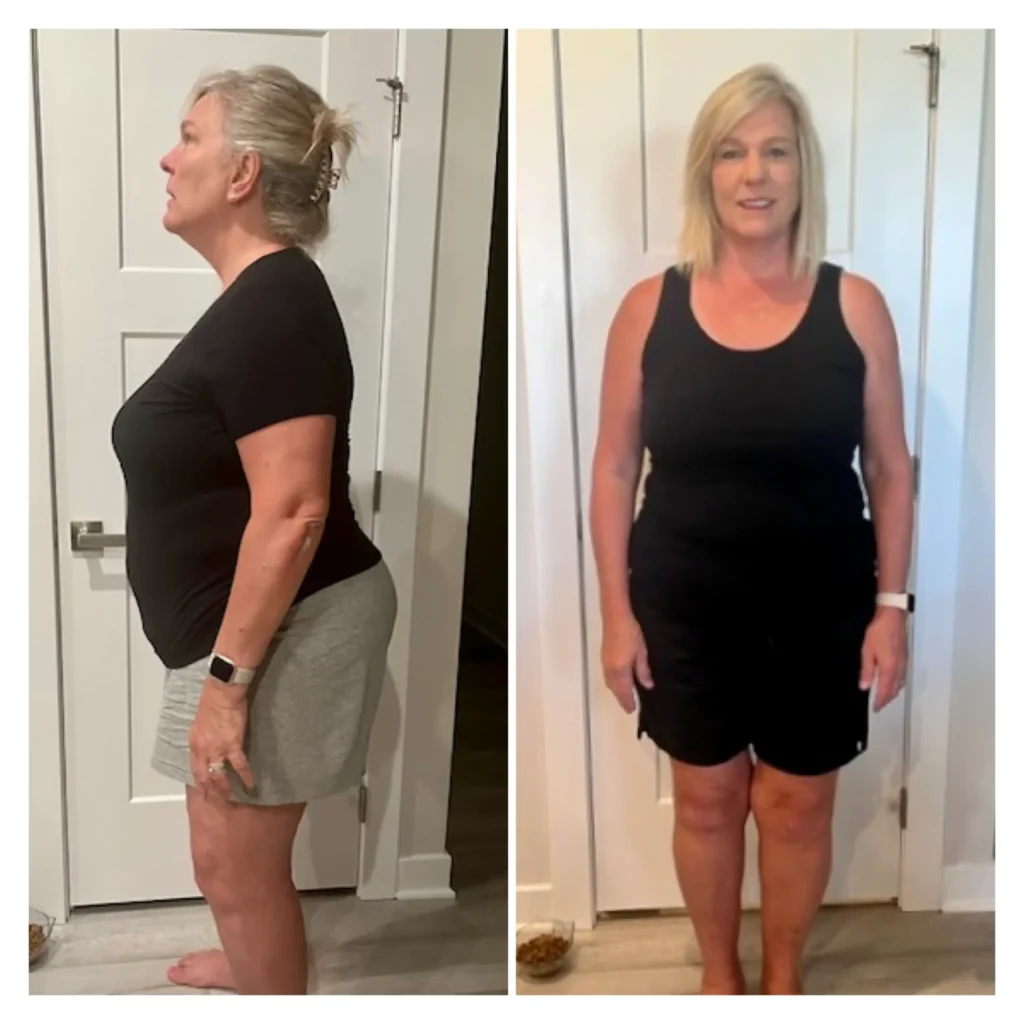 Sue before and after weight loss