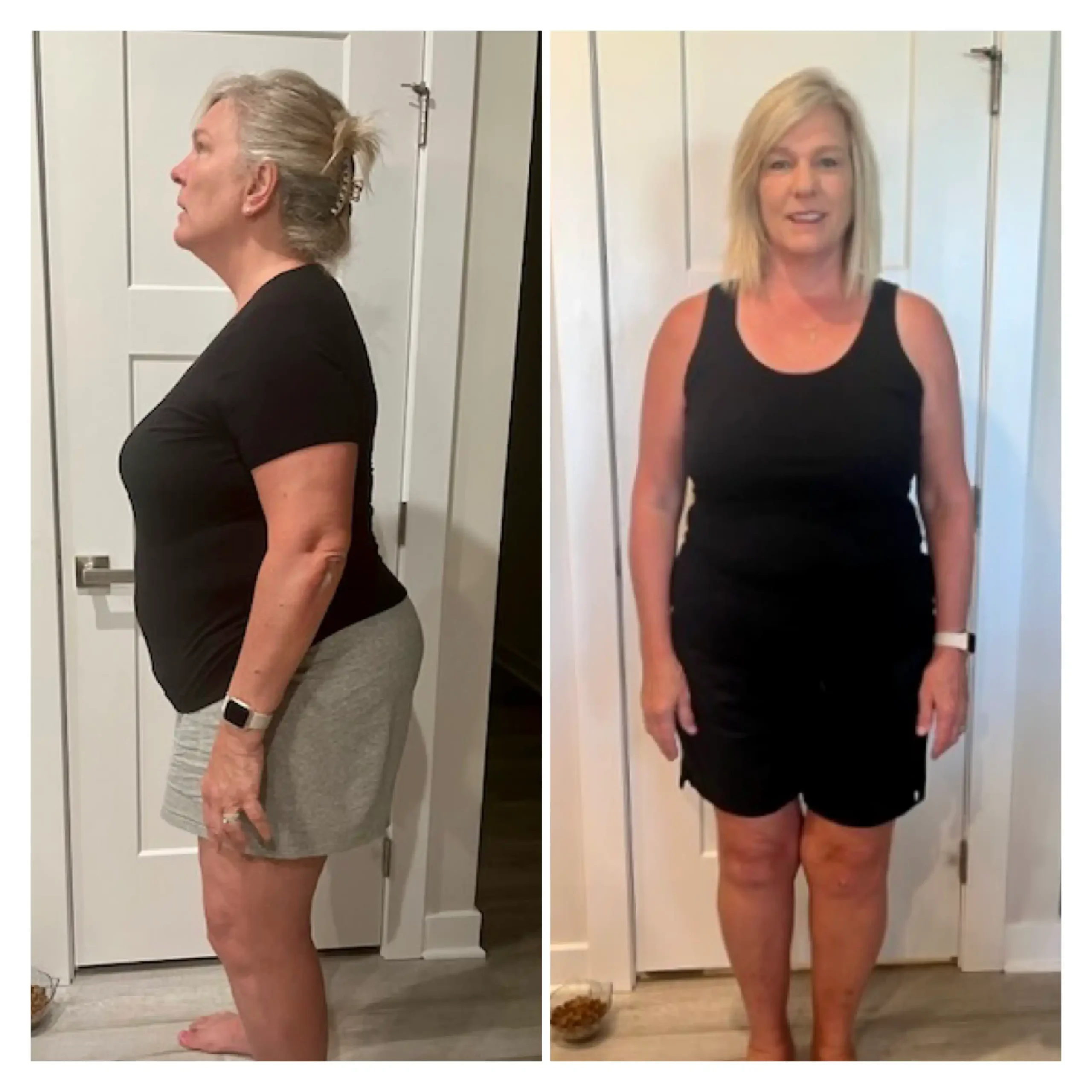 Sue before and after weight loss