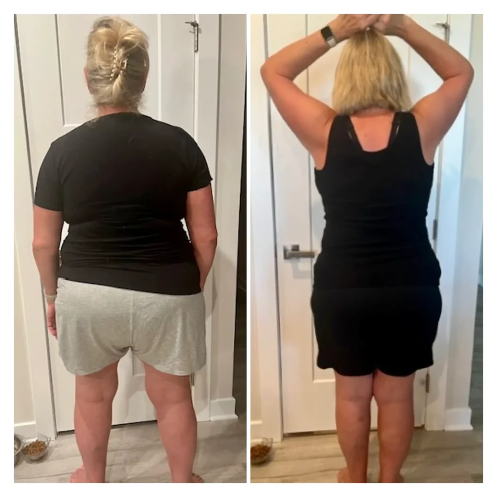Sue before and after weight loss back view