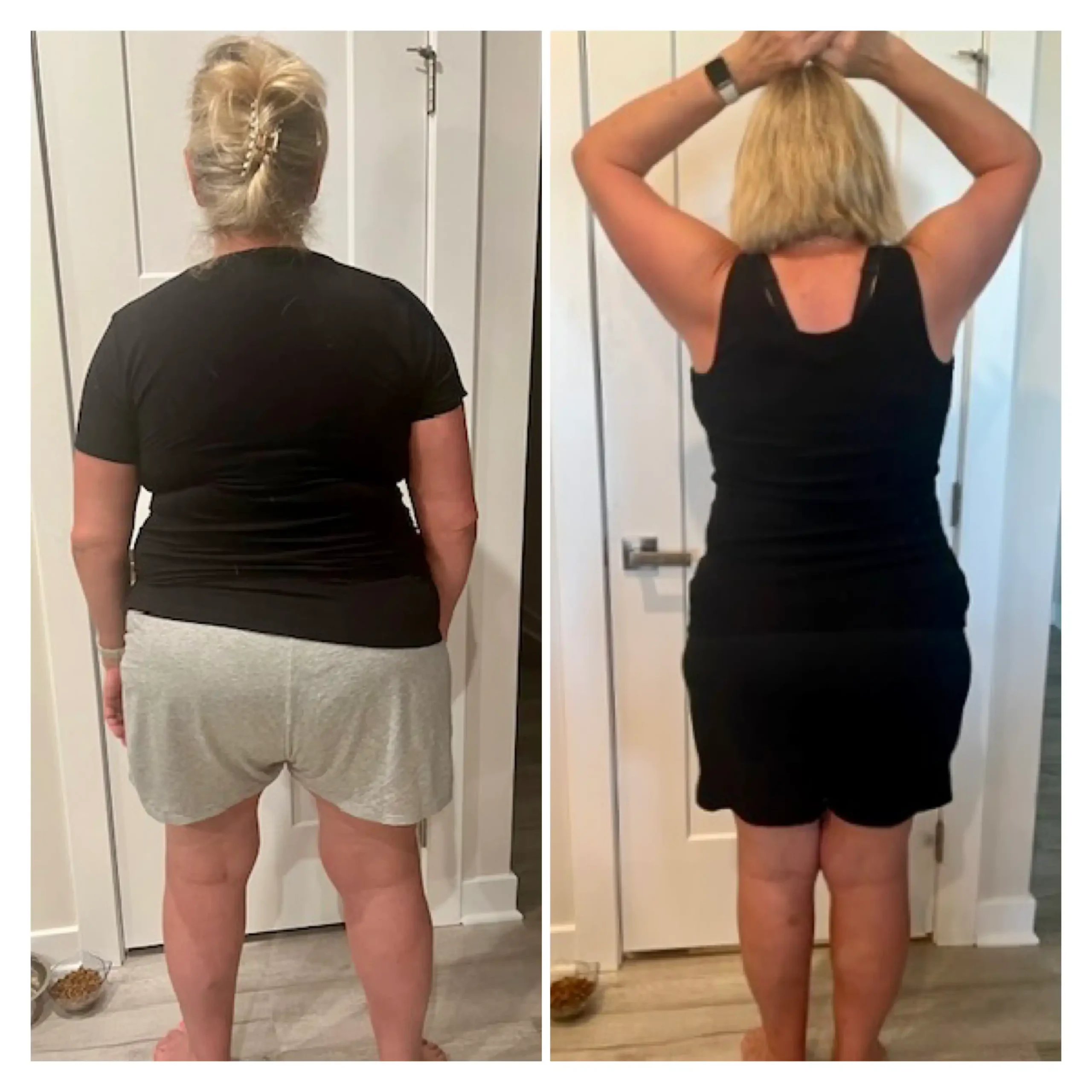 Sue before and after weight loss back view