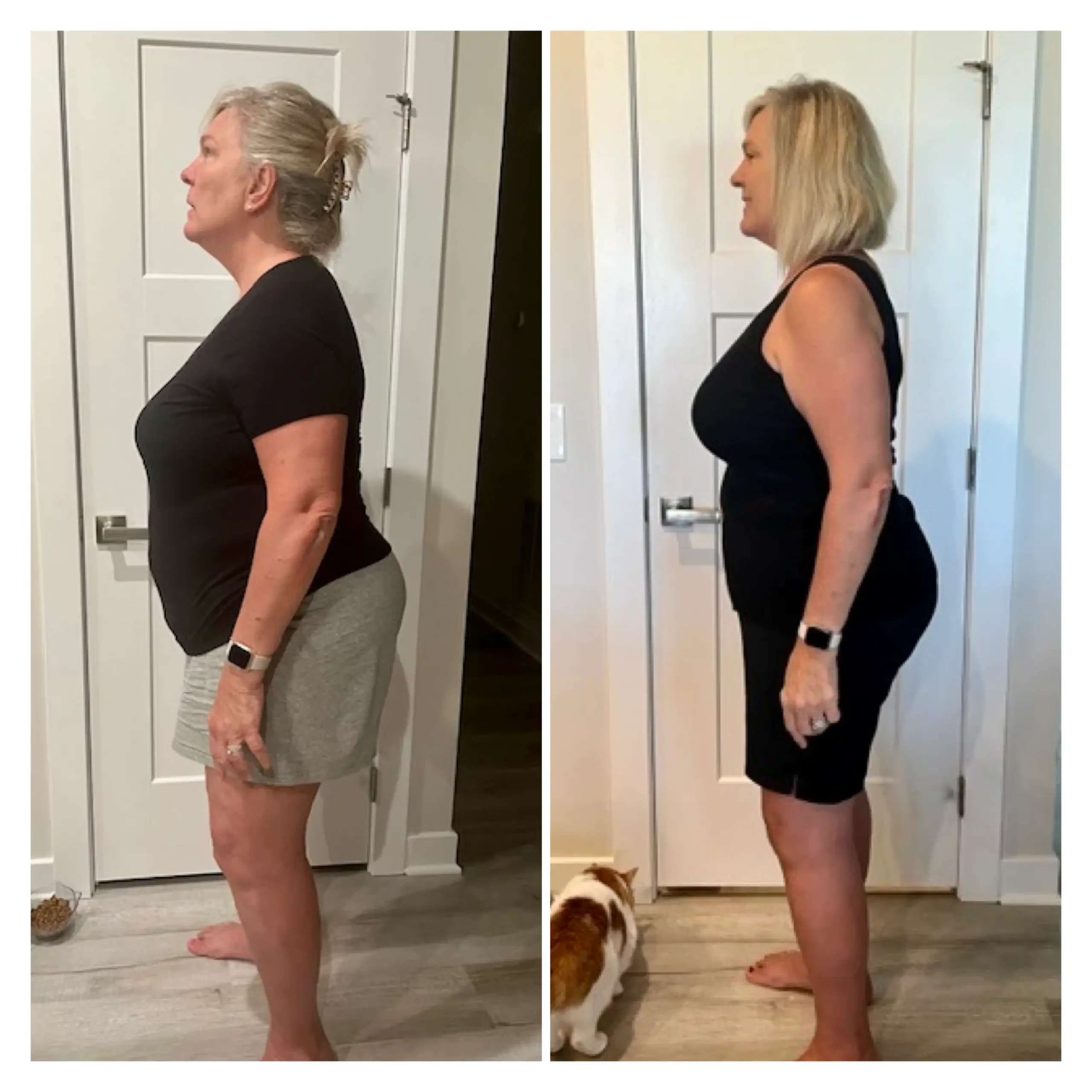Sue before and after weight loss side view