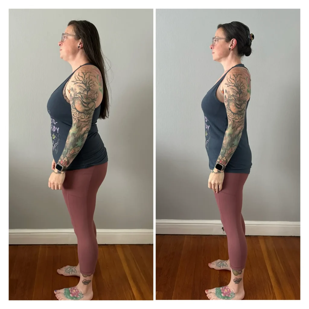 Amber before and after weight loss side view