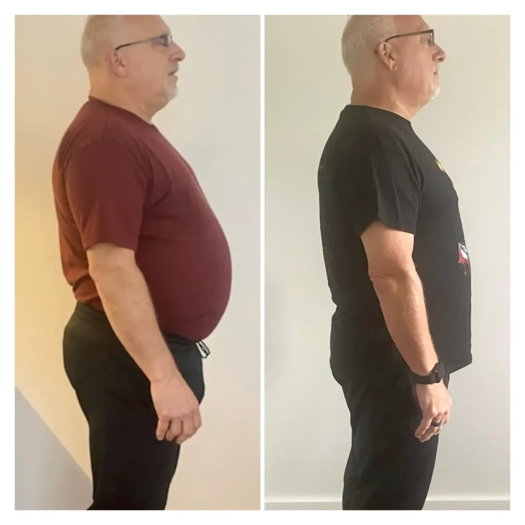 Dan H before and after weight loss side view