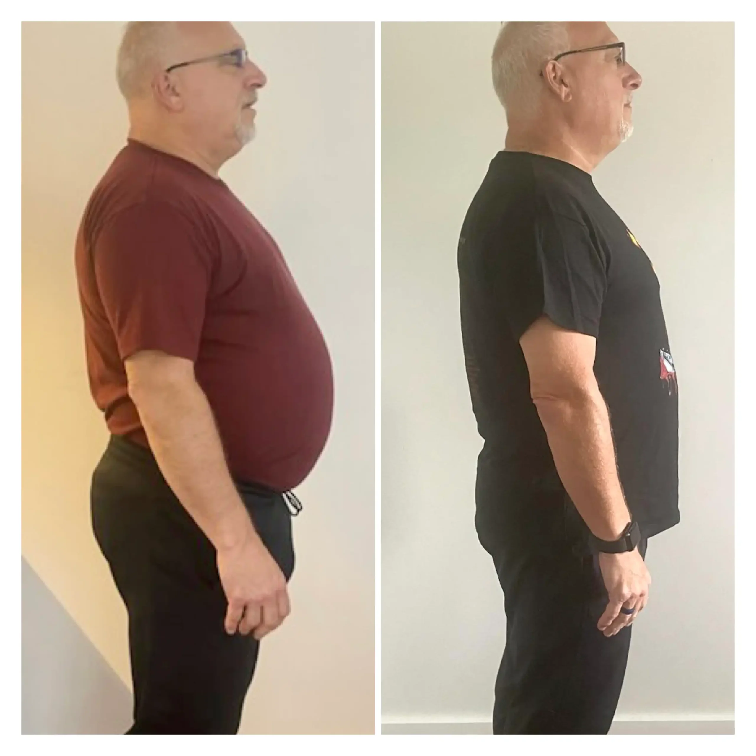 Dan H before and after weight loss side view