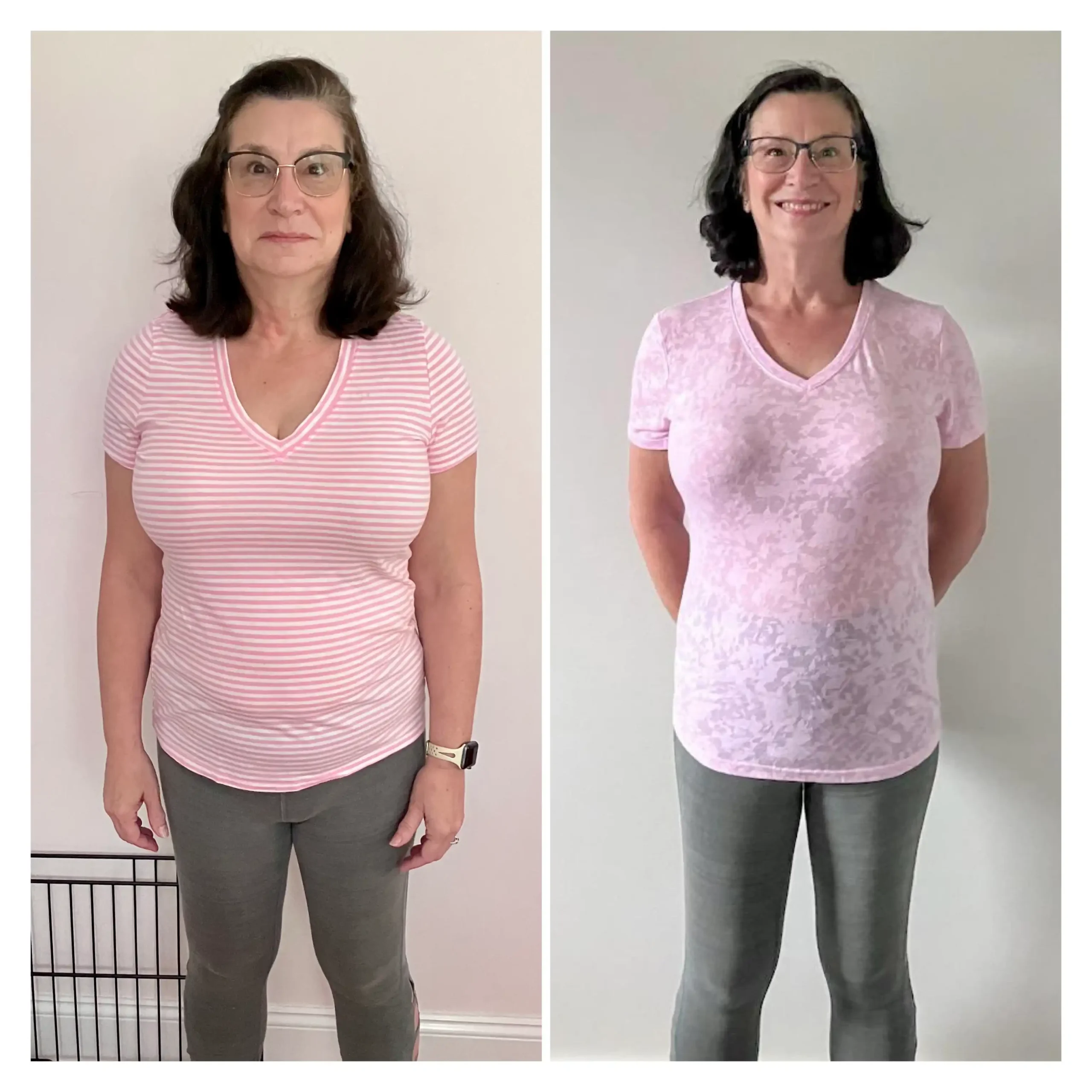 Jane before and after weight loss front view