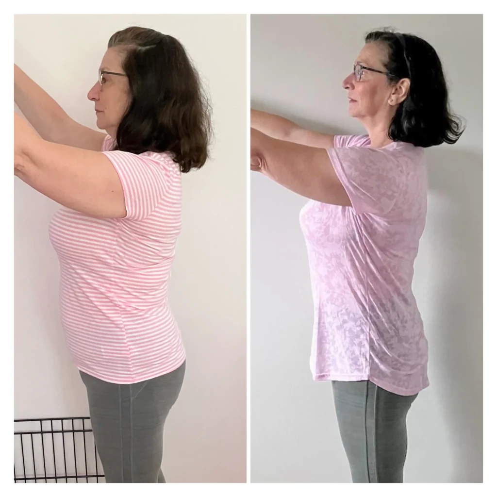 Jane before and after weight loss side view