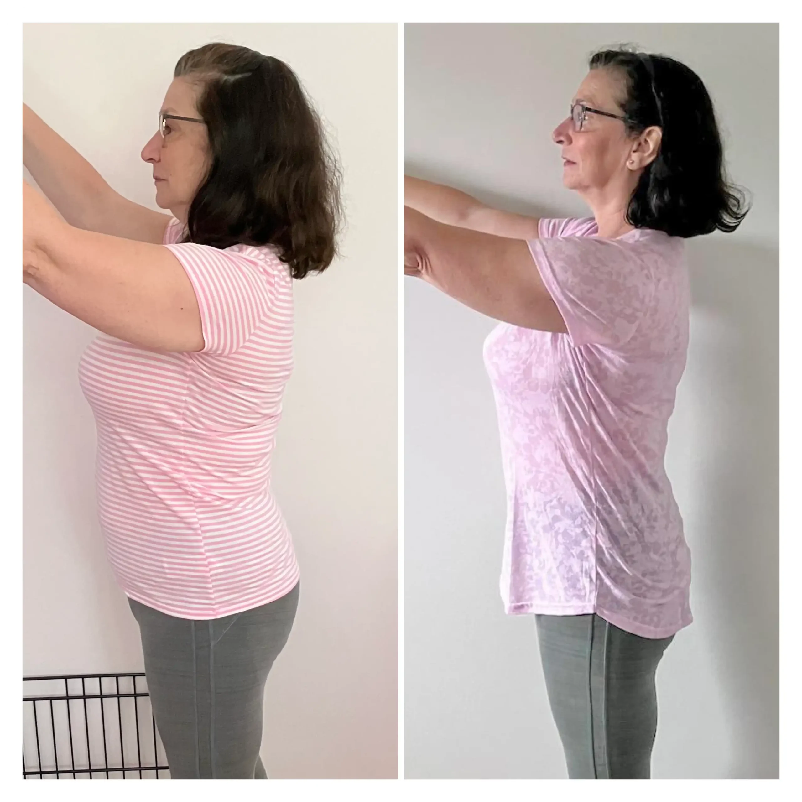 Jane before and after weight loss side view