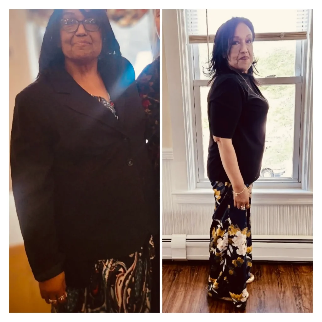 Teri before and after weight loss