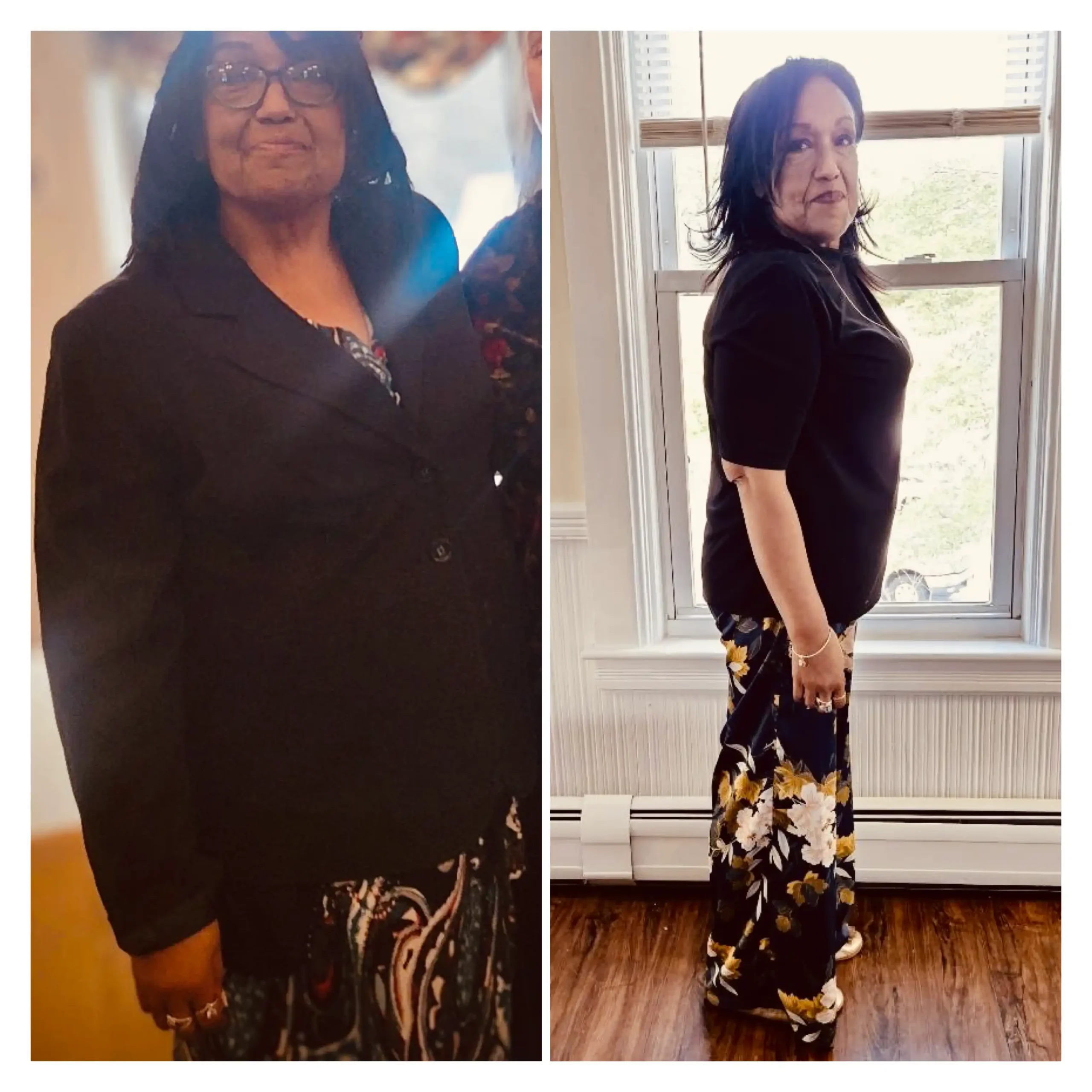 Teri before and after weight loss