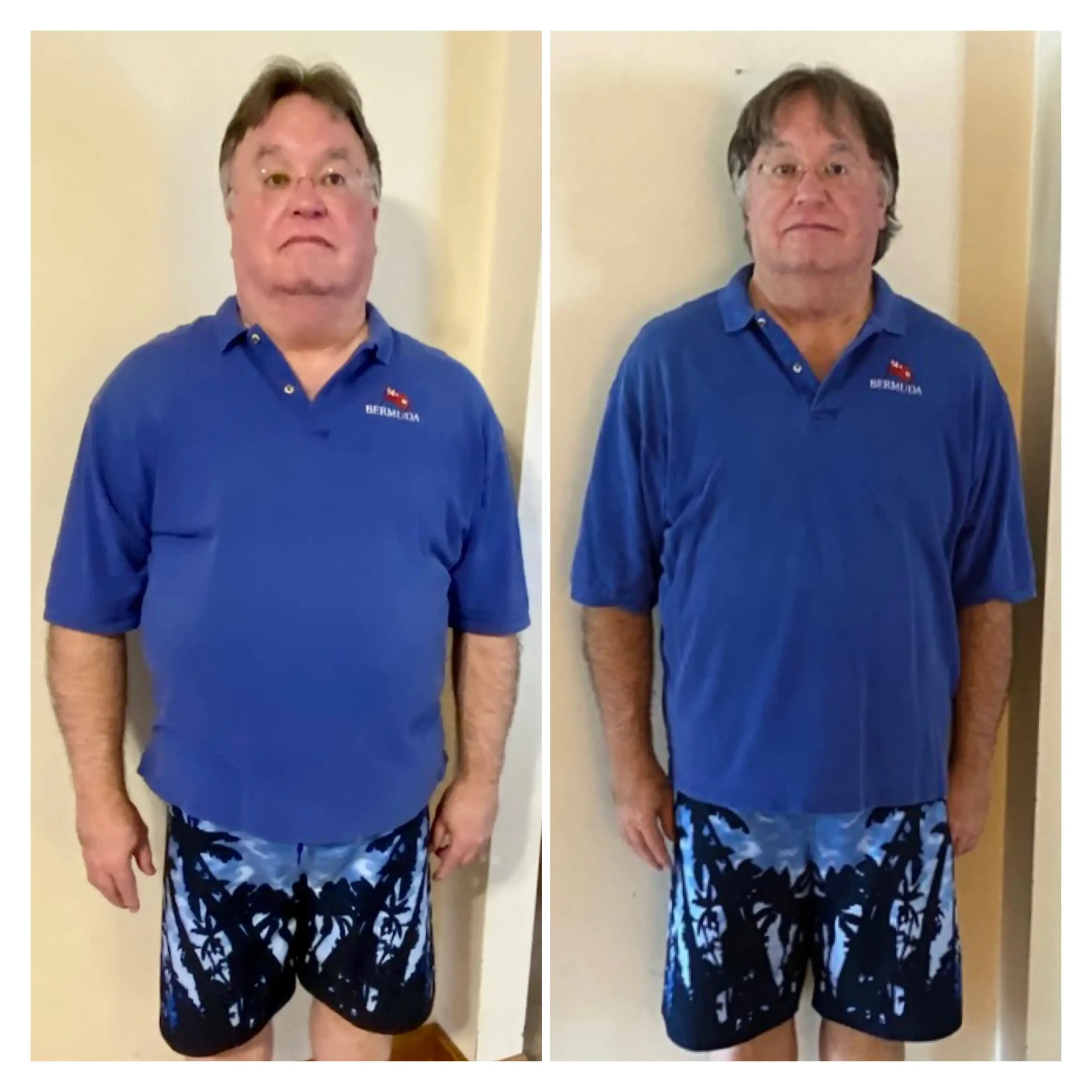 Dan S. before and after weight loss front view
