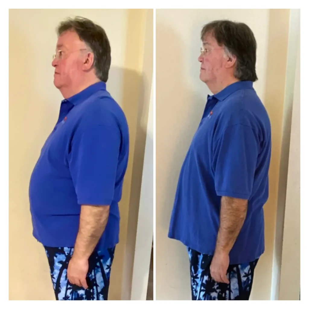 Dan S. before and after weight loss side view