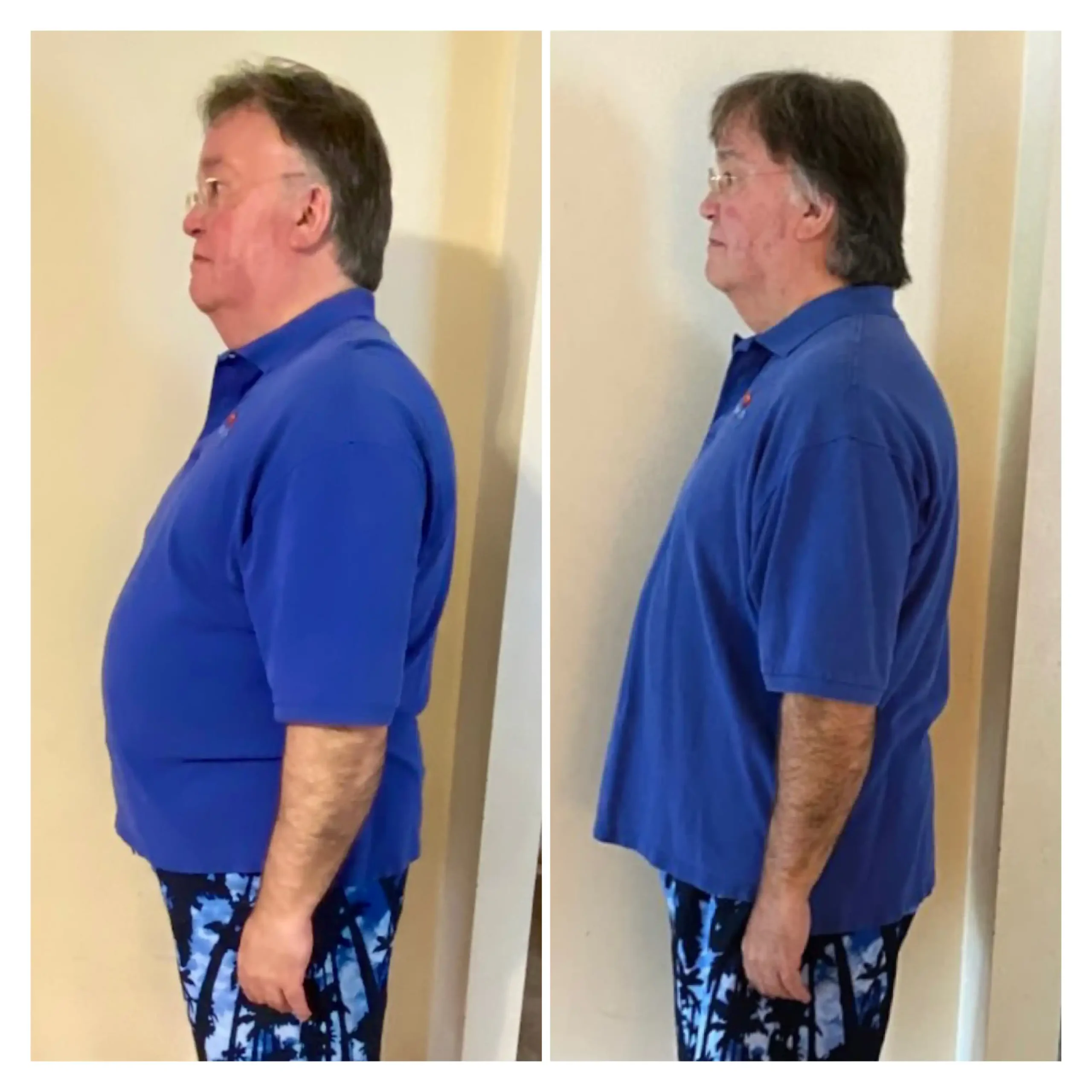 Dan S. before and after weight loss side view